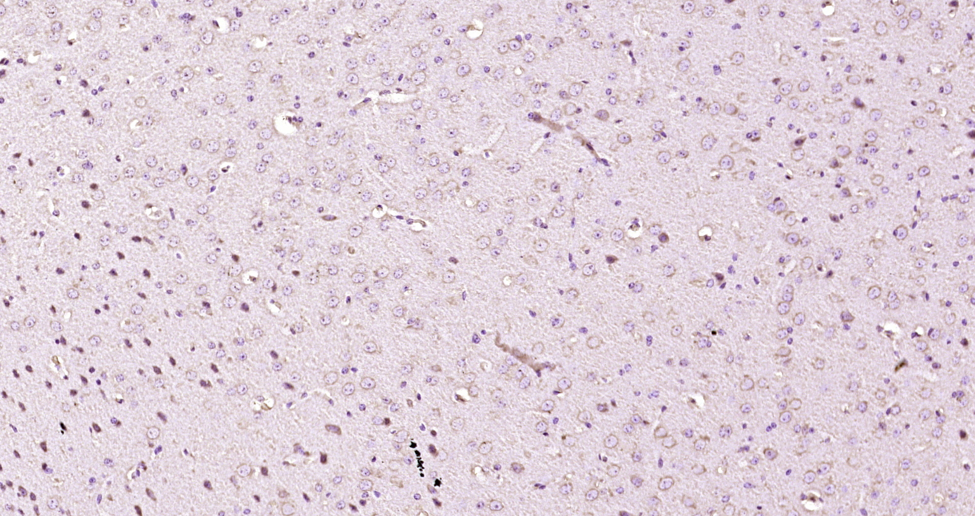Paraformaldehyde-fixed, paraffin embedded Mouse brain; Antigen retrieval by boiling in sodium citrate buffer (pH6.0) for 15min; Block endogenous peroxidase by 3% hydrogen peroxide for 20 minutes; Blocking buffer (normal goat serum) at 37°C for 30min; Antibody incubation with PTN Polyclonal Antibody, Unconjugated (bs-21928R) at 1:200 overnight at 4°C, DAB staining.