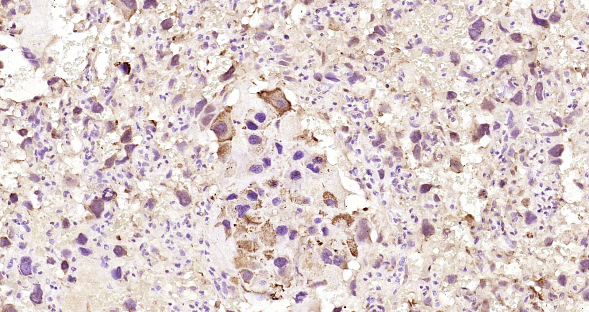 Paraformaldehyde-fixed, paraffin embedded Rat placenta; Antigen retrieval by boiling in sodium citrate buffer (pH6.0) for 15min; Block endogenous peroxidase by 3% hydrogen peroxide for 20 minutes; Blocking buffer (normal goat serum) at 37°C for 30min; Antibody incubation with GPX3 Polyclonal Antibody, Unconjugated (bs-22009R) at 1:200 overnight at 4°C, DAB staining.