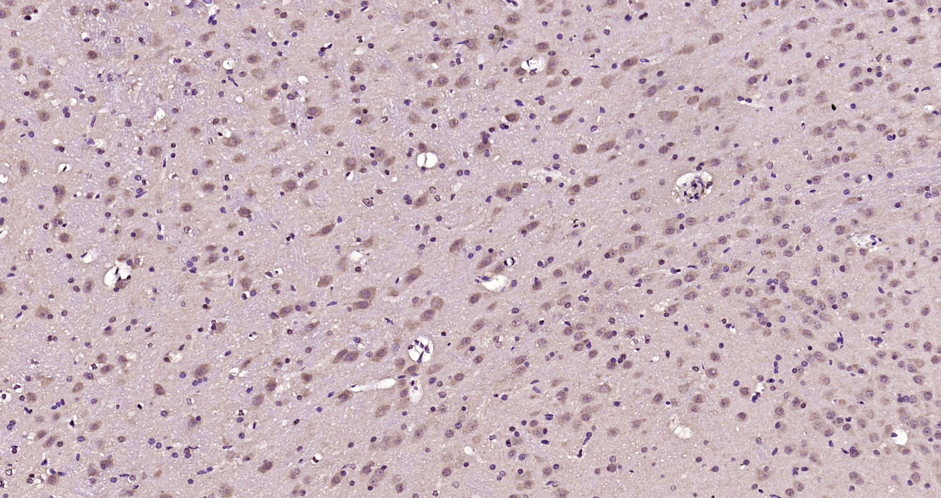 Paraformaldehyde-fixed, paraffin embedded Rat brain; Antigen retrieval by boiling in sodium citrate buffer (pH6.0) for 15min; Block endogenous peroxidase by 3% hydrogen peroxide for 20 minutes; Blocking buffer (normal goat serum) at 37°C for 30min; Antibody incubation with RIM2 Polyclonal Antibody, Unconjugated (bs-22118R) at 1:200 overnight at 4°C, DAB staining.