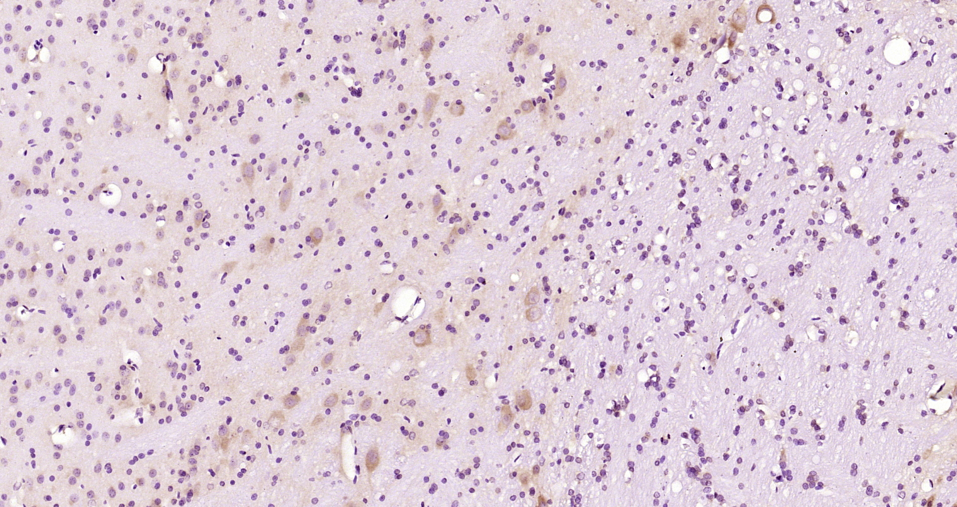 Paraformaldehyde-fixed, paraffin embedded Rat brain; Antigen retrieval by boiling in sodium citrate buffer (pH6.0) for 15min; Block endogenous peroxidase by 3% hydrogen peroxide for 20 minutes; Blocking buffer (normal goat serum) at 37°C for 30min; Antibody incubation with Artemin Polyclonal Antibody, Unconjugated (bs-22202R) at 1:200 overnight at 4°C, DAB staining.
