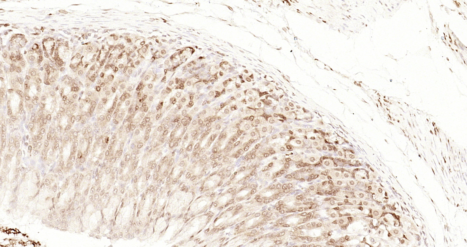 Paraformaldehyde-fixed, paraffin embedded Rat stomach; Antigen retrieval by boiling in sodium citrate buffer (pH6.0) for 15min; Block endogenous peroxidase by 3% hydrogen peroxide for 20 minutes; Blocking buffer (normal goat serum) at 37°C for 30min; Antibody incubation with CDCA7 Polyclonal Antibody, Unconjugated (bs-22227R) at 1:200 overnight at 4°C, DAB staining.