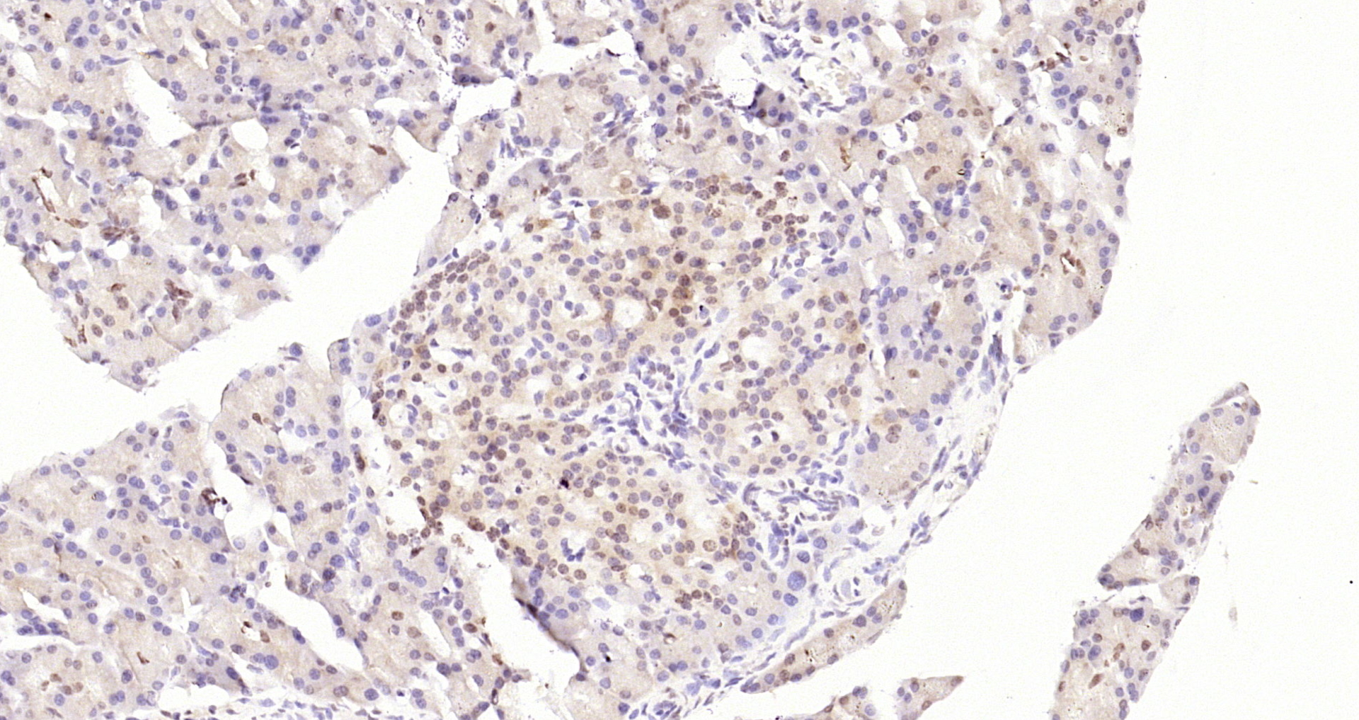 Paraformaldehyde-fixed, paraffin embedded Rat pancreas; Antigen retrieval by boiling in sodium citrate buffer (pH6.0) for 15min; Block endogenous peroxidase by 3% hydrogen peroxide for 20 minutes; Blocking buffer (normal goat serum) at 37°C for 30min; Antibody incubation with CDCA7 Polyclonal Antibody, Unconjugated (bs-22227R) at 1:200 overnight at 4°C, DAB staining.