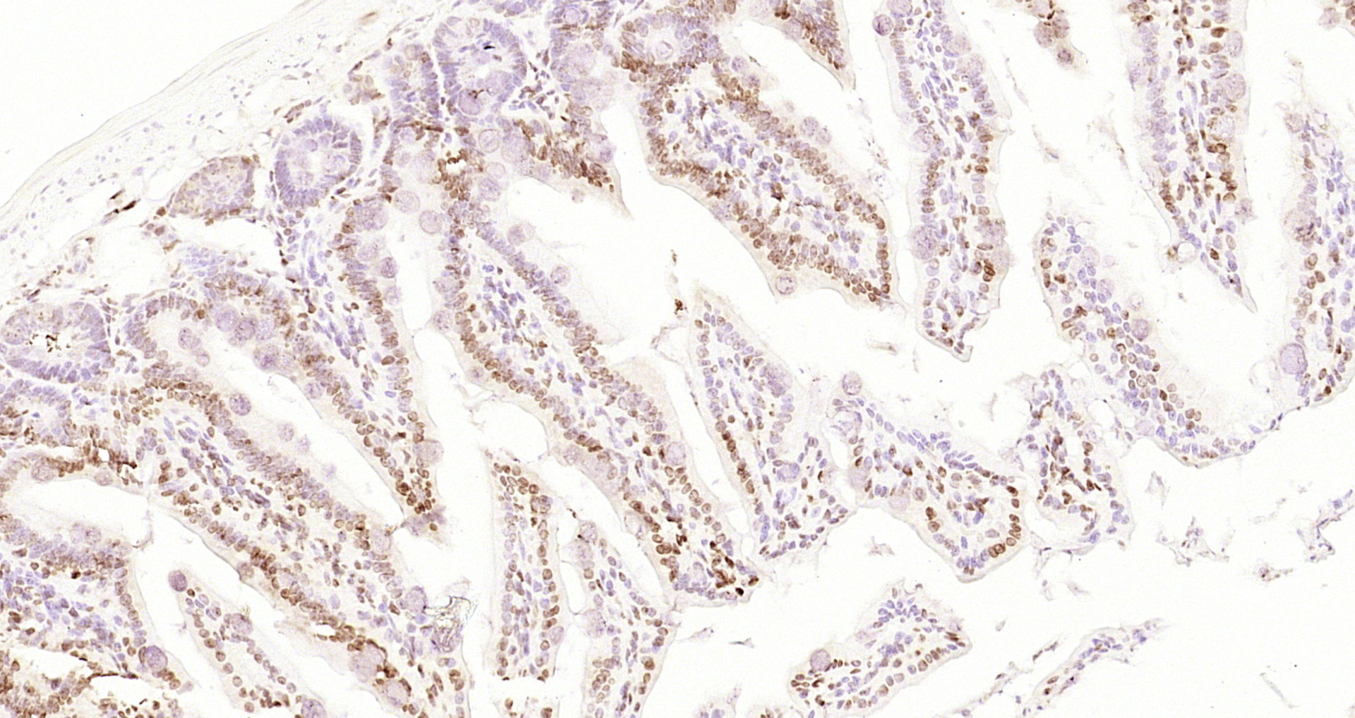 Paraformaldehyde-fixed, paraffin embedded Mouse intestine; Antigen retrieval by boiling in sodium citrate buffer (pH6.0) for 15min; Block endogenous peroxidase by 3% hydrogen peroxide for 20 minutes; Blocking buffer (normal goat serum) at 37°C for 30min; Antibody incubation with CDCA7 Polyclonal Antibody, Unconjugated (bs-22227R) at 1:200 overnight at 4°C, DAB staining.