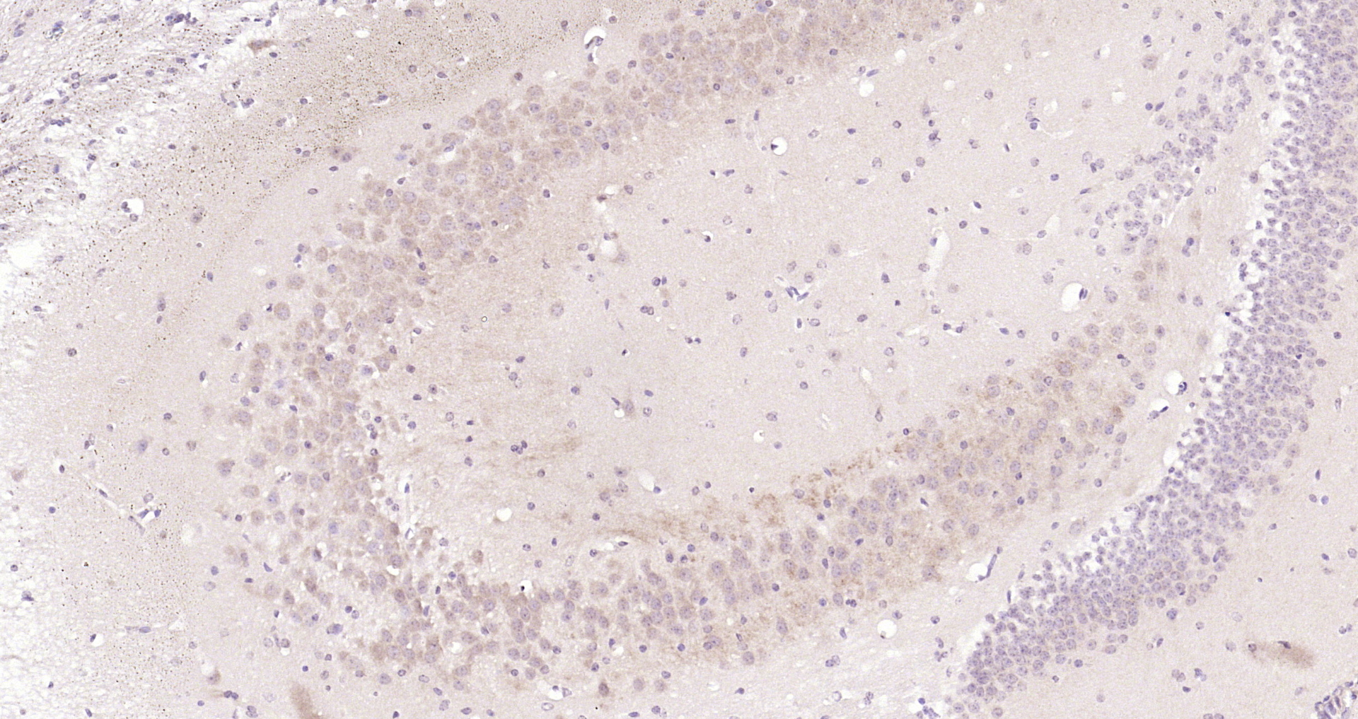 Paraformaldehyde-fixed, paraffin embedded Mouse brain; Antigen retrieval by boiling in sodium citrate buffer (pH6.0) for 15min; Block endogenous peroxidase by 3% hydrogen peroxide for 20 minutes; Blocking buffer (normal goat serum) at 37°C for 30min; Antibody incubation with CTNND2/delta 2 Catenin Polyclonal Antibody, Unconjugated (bs-22251R) at 1:200 overnight at 4°C, DAB staining. Paraformaldehyde-fixed, paraffin embedded Mouse brain; Antigen retrieval by boiling in sodium citrate buffer (pH6.0) for 15min; Block endogenous peroxidase by 3% hydrogen peroxide for 20 minutes; Blocking buffer (normal goat serum) at 37°C for 30min; Antibody incubation with CTNND2/delta 2 Catenin Polyclonal Antibody, Unconjugated (bs-22251R) at 1:200 overnight at 4°C, DAB staining.