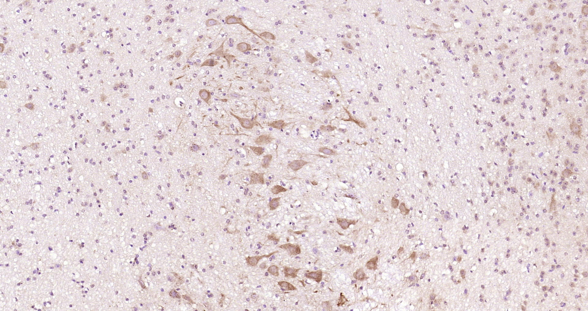 Paraformaldehyde-fixed, paraffin embedded Mouse cerebellum; Antigen retrieval by boiling in sodium citrate buffer (pH6.0) for 15min; Block endogenous peroxidase by 3% hydrogen peroxide for 20 minutes; Blocking buffer (normal goat serum) at 37°C for 30min; Antibody incubation with CTNND2/delta 2 Catenin Polyclonal Antibody, Unconjugated (bs-22251R) at 1:200 overnight at 4°C, DAB staining. Paraformaldehyde-fixed, paraffin embedded Mouse cerebellum; Antigen retrieval by boiling in sodium citrate buffer (pH6.0) for 15min; Block endogenous peroxidase by 3% hydrogen peroxide for 20 minutes; Blocking buffer (normal goat serum) at 37°C for 30min; Antibody incubation with CTNND2/delta 2 Catenin Polyclonal Antibody, Unconjugated (bs-22251R) at 1:200 overnight at 4°C, DAB staining.