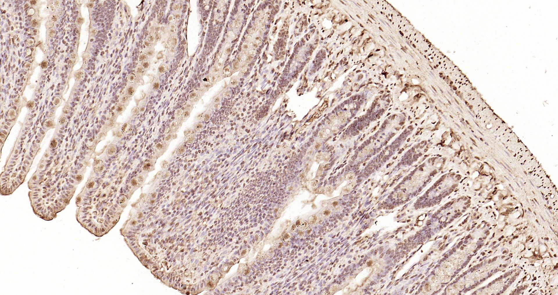 Paraformaldehyde-fixed, paraffin embedded Mouse intestine; Antigen retrieval by boiling in sodium citrate buffer (pH6.0) for 15min; Block endogenous peroxidase by 3% hydrogen peroxide for 20 minutes; Blocking buffer (normal goat serum) at 37°C for 30min; Antibody incubation with CDKN1A/p21 Polyclonal Antibody, Unconjugated (bs-22795R) at 1:200 overnight at 4°C, DAB staining.