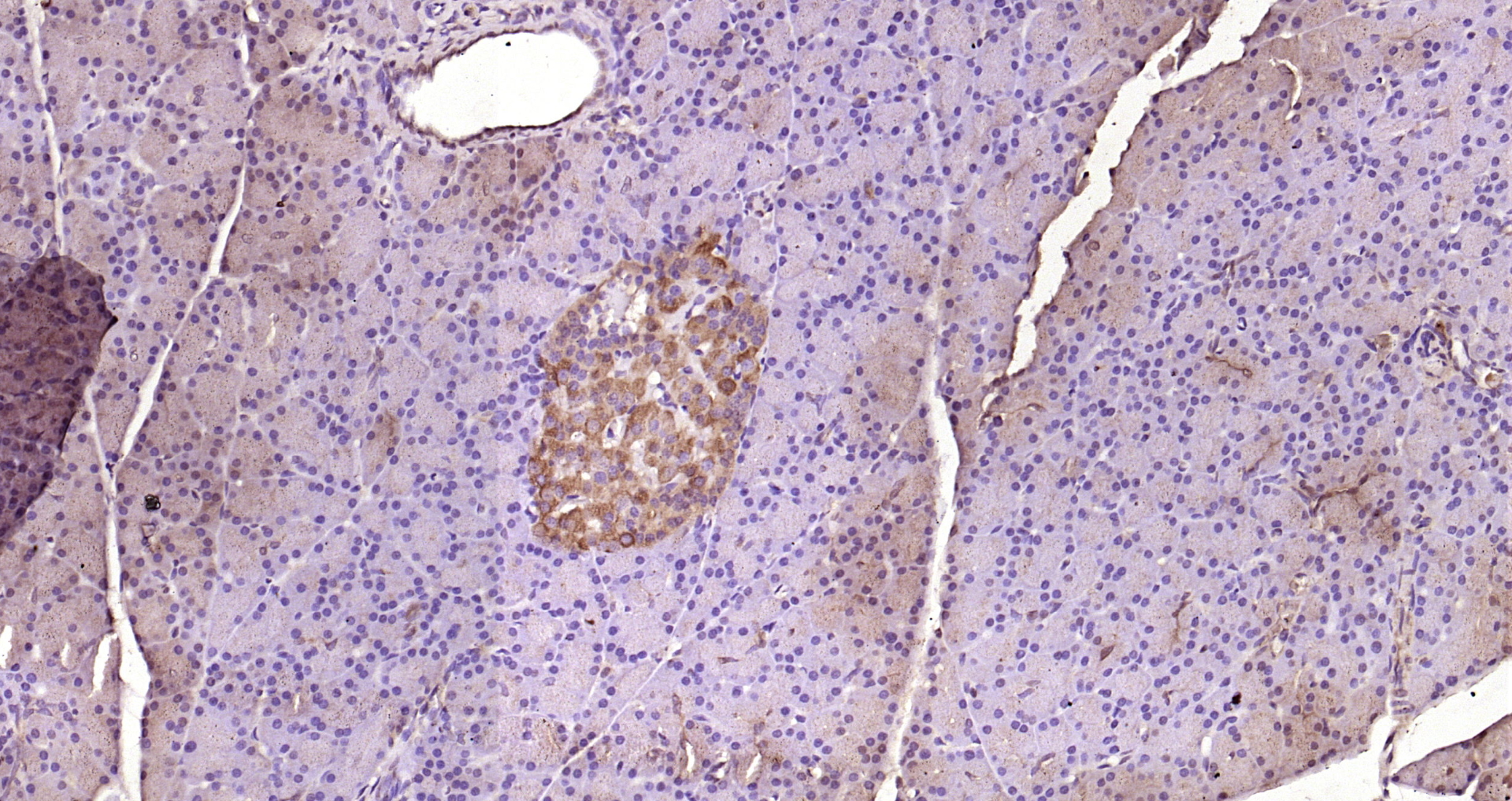 Paraformaldehyde-fixed, paraffin embedded Rat pancreas; Antigen retrieval by boiling in sodium citrate buffer (pH6.0) for 15min; Block endogenous peroxidase by 3% hydrogen peroxide for 20 minutes; Blocking buffer (normal goat serum) at 37°C for 30min; Antibody incubation with phospho-p38 MAPK (Tyr323) Polyclonal Antibody, Unconjugated (bs-23251R) at 1:200 overnight at 4°C, DAB staining.