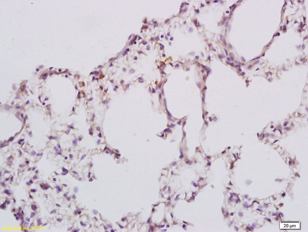 Formalin-fixed and paraffin embedded rat lung tissue labeled with Anti GPR78 Polyclonal Antibody, Unconjugated (bs-1807R) at 1:200 followed by conjugation to the secondary antibody and DAB staining
