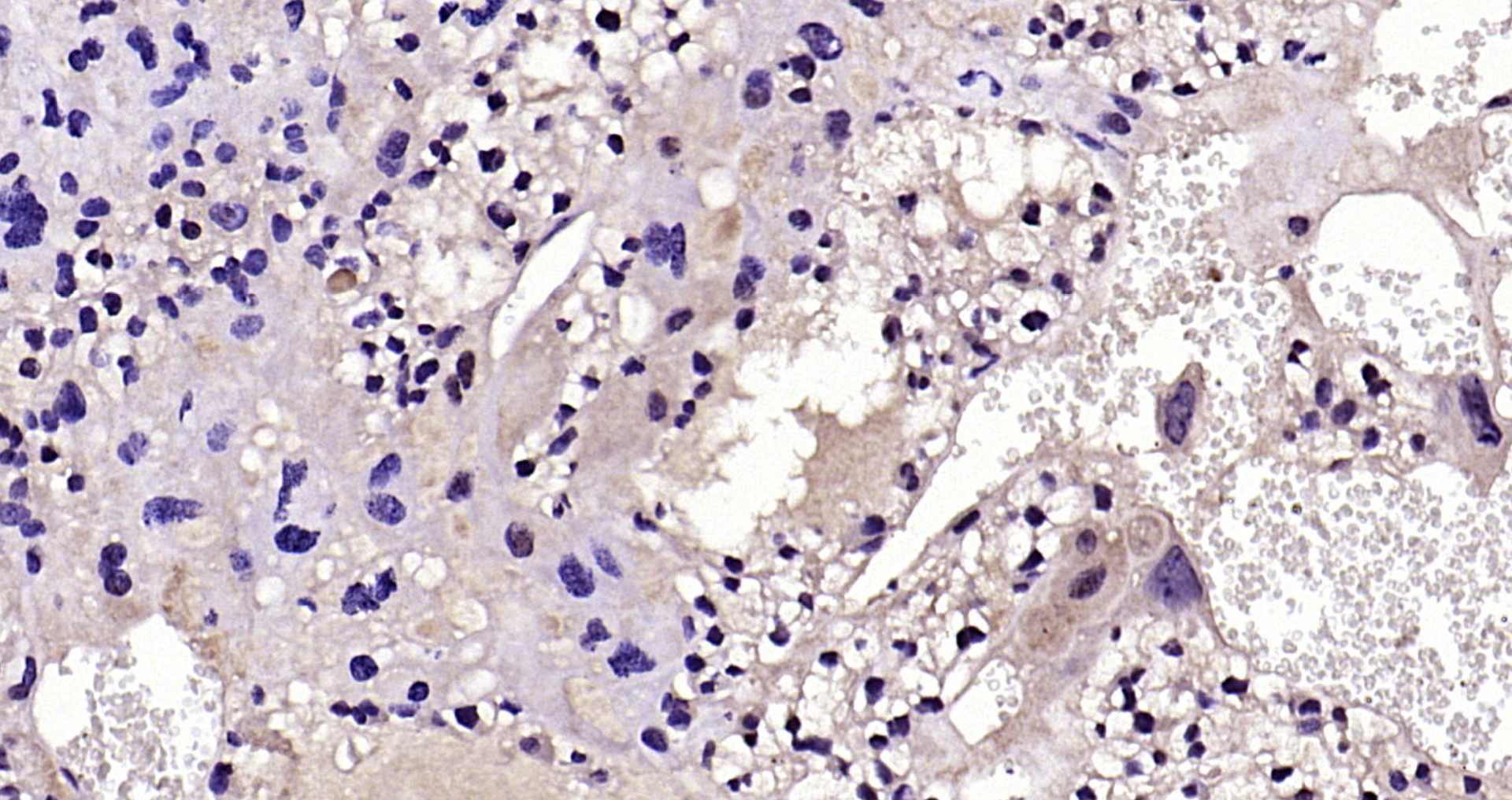Paraformaldehyde-fixed, paraffin embedded Mouse placenta; Antigen retrieval by boiling in sodium citrate buffer (pH6.0) for 15min; Block endogenous peroxidase by 3% hydrogen peroxide for 20 minutes; Blocking buffer (normal goat serum) at 37°C for 30min; Antibody incubation with Fas Ligand Polyclonal Antibody, Unconjugated (bs-0216R) at 1:200 overnight at 4°C, DAB staining.