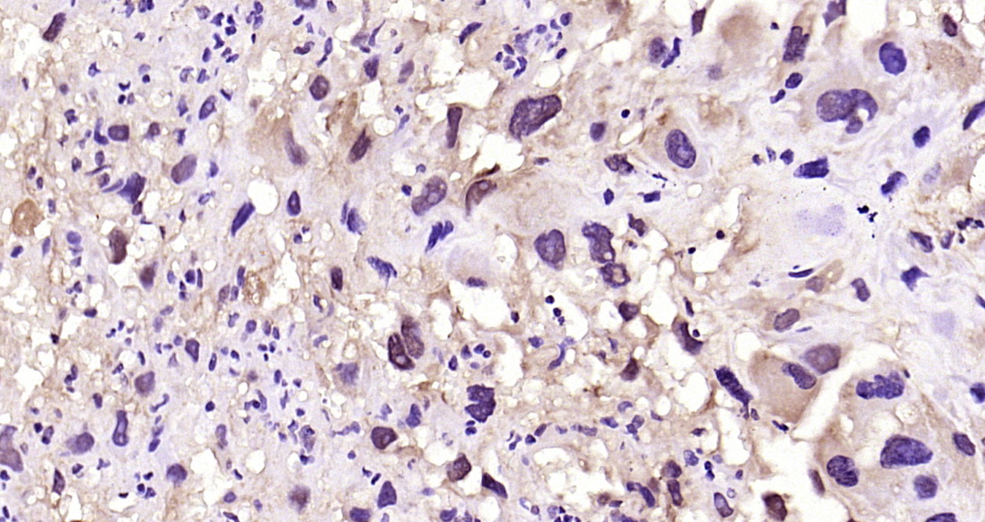Paraformaldehyde-fixed, paraffin embedded Rat placenta; Antigen retrieval by boiling in sodium citrate buffer (pH6.0) for 15min; Block endogenous peroxidase by 3% hydrogen peroxide for 20 minutes; Blocking buffer (normal goat serum) at 37°C for 30min; Antibody incubation with Oct-4 Polyclonal Antibody, Unconjugated (bs-1111R) at 1:200 overnight at 4°C, DAB staining. Paraformaldehyde-fixed, paraffin embedded Rat placenta; Antigen retrieval by boiling in sodium citrate buffer (pH6.0) for 15min; Block endogenous peroxidase by 3% hydrogen peroxide for 20 minutes; Blocking buffer (normal goat serum) at 37°C for 30min; Antibody incubation with Oct-4 Polyclonal Antibody, Unconjugated (bs-1111R) at 1:200 overnight at 4°C, DAB staining.