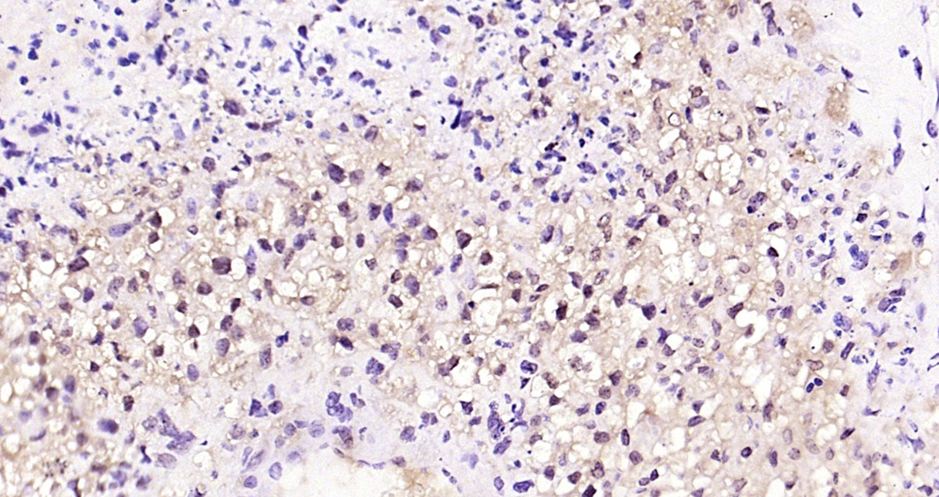 Paraformaldehyde-fixed, paraffin embedded Mouse placenta; Antigen retrieval by boiling in sodium citrate buffer (pH6.0) for 15min; Block endogenous peroxidase by 3% hydrogen peroxide for 20 minutes; Blocking buffer (normal goat serum) at 37°C for 30min; Antibody incubation with Oct-4 Polyclonal Antibody, Unconjugated (bs-1111R) at 1:200 overnight at 4°C, DAB staining. Paraformaldehyde-fixed, paraffin embedded Mouse placenta; Antigen retrieval by boiling in sodium citrate buffer (pH6.0) for 15min; Block endogenous peroxidase by 3% hydrogen peroxide for 20 minutes; Blocking buffer (normal goat serum) at 37°C for 30min; Antibody incubation with Oct-4 Polyclonal Antibody, Unconjugated (bs-1111R) at 1:200 overnight at 4°C, DAB staining.