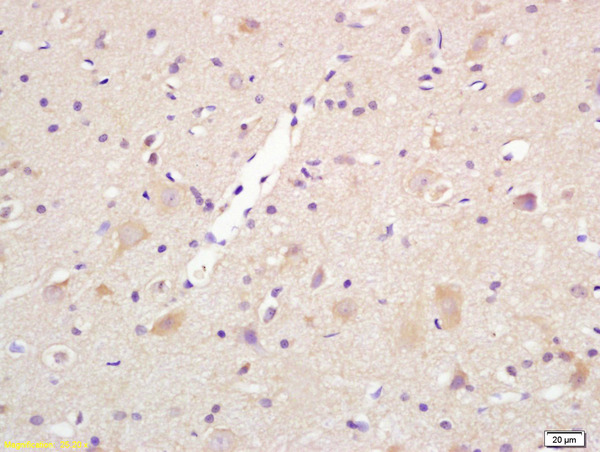 Formalin-fixed and paraffin embedded rat brain labeled with Rabbit Anti Centaurin alpha 1 Polyclonal Antibody, Unconjugated (bs-11543R) at 1:200 followed by conjugation to the secondary antibody and DAB staining