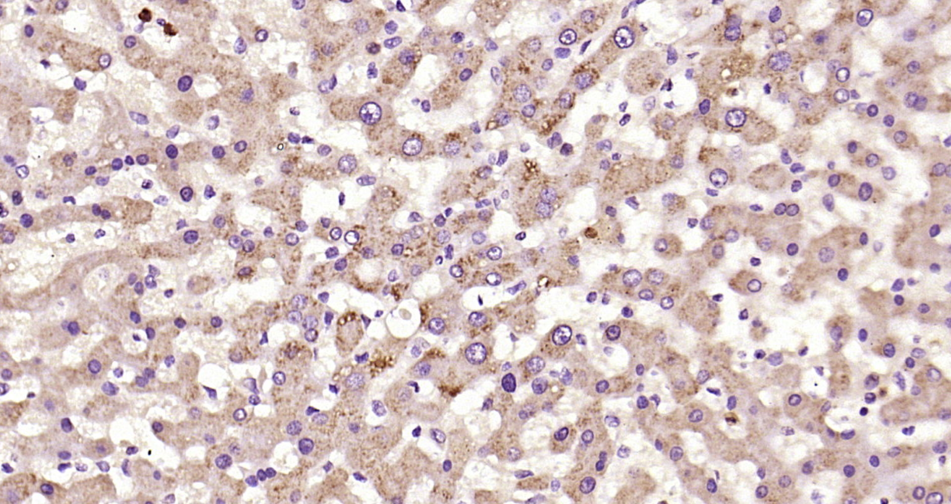 Paraformaldehyde-fixed, paraffin embedded Human liver; Antigen retrieval by boiling in sodium citrate buffer (pH6.0) for 15min; Block endogenous peroxidase by 3% hydrogen peroxide for 20 minutes; Blocking buffer (normal goat serum) at 37°C for 30min; Antibody incubation with C5a anaphylatoxin Polyclonal Antibody, Unconjugated (bs-10476R) at 1:200 overnight at 4°C, DAB staining.