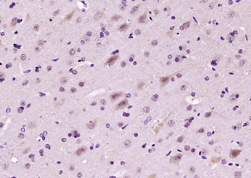 Paraformaldehyde-fixed, paraffin embedded Rat brain; Antigen retrieval by boiling in sodium citrate buffer (pH6.0) for 15min; Block endogenous peroxidase by 3% hydrogen peroxide for 20 minutes; Blocking buffer (normal goat serum) at 37°C for 30min; Antibody incubation with NR3C2/Mineralocorticoid receptor Polyclonal Antibody, Unconjugated (bs-21356R) at 1:200 overnight at 4°C, DAB staining.