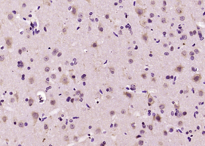 Paraformaldehyde-fixed, paraffin embedded Rat brain; Antigen retrieval by boiling in sodium citrate buffer (pH6.0) for 15min; Block endogenous peroxidase by 3% hydrogen peroxide for 20 minutes; Blocking buffer (normal goat serum) at 37°C for 30min; Antibody incubation with NR3C2/Mineralocorticoid receptor Polyclonal Antibody, Unconjugated (bs-21357R) at 1:200 overnight at 4°C, DAB staining.