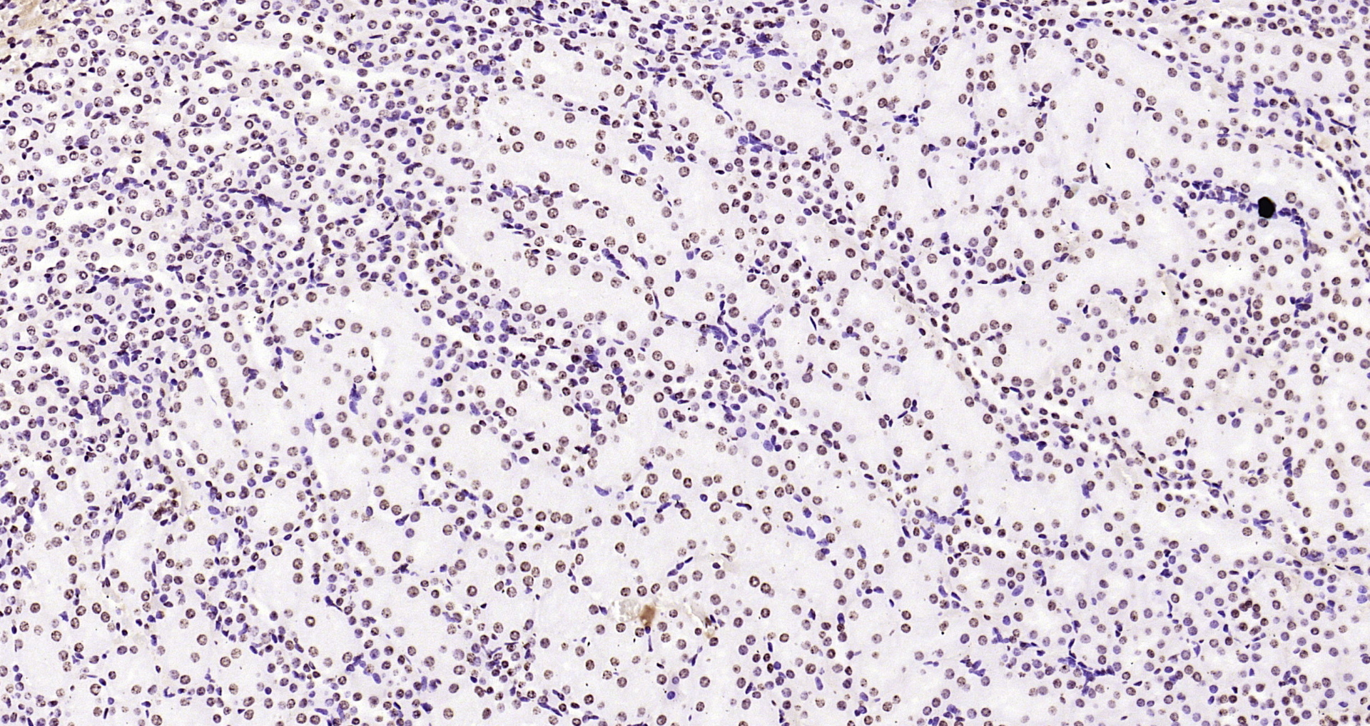 Paraformaldehyde-fixed, paraffin embedded Mouse kidney; Antigen retrieval by boiling in sodium citrate buffer (pH6.0) for 15min; Block endogenous peroxidase by 3% hydrogen peroxide for 20 minutes; Blocking buffer (normal goat serum) at 37°C for 30min; Antibody incubation with Histone H3(di methyl K36) Monoclonal Antibody, Unconjugated (bsm-33124M) at 1:2000 overnight at 4°C, DAB staining.
