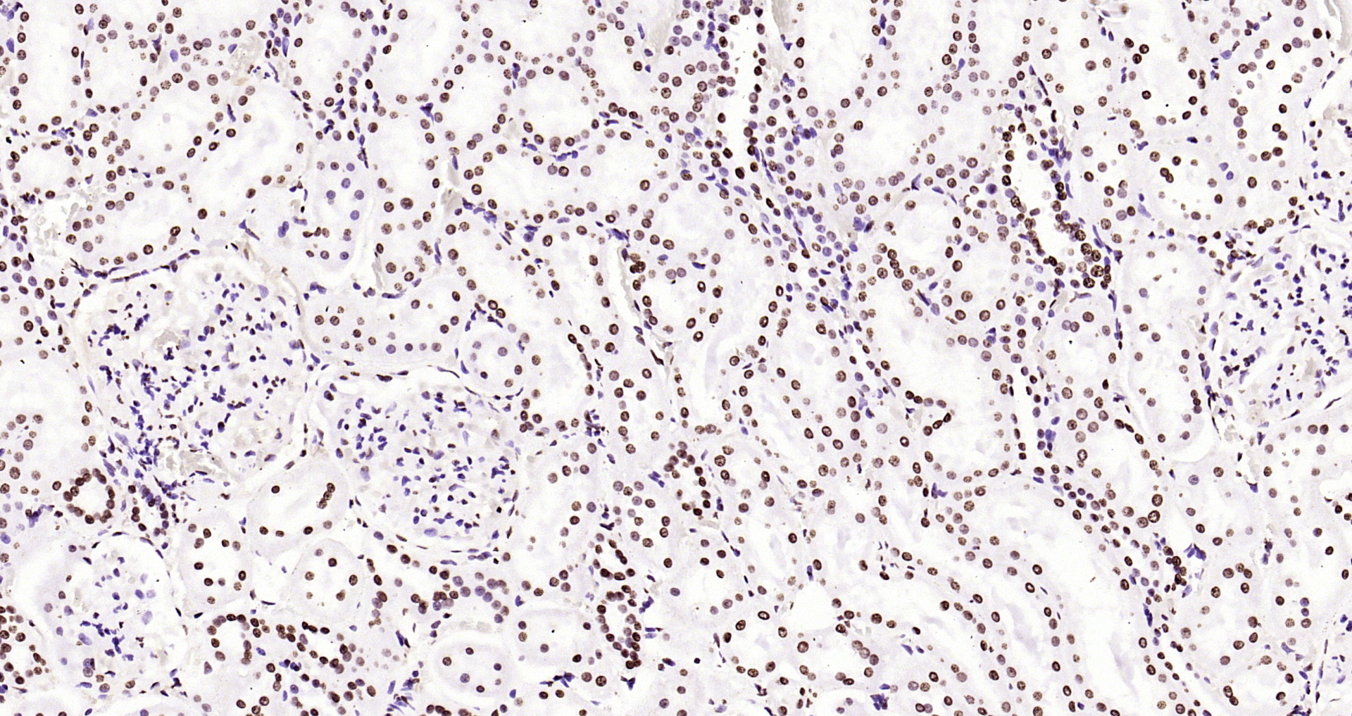 Paraformaldehyde-fixed, paraffin embedded Rat kidney; Antigen retrieval by boiling in sodium citrate buffer (pH6.0) for 15min; Block endogenous peroxidase by 3% hydrogen peroxide for 20 minutes; Blocking buffer (normal goat serum) at 37°C for 30min; Antibody incubation with Histone H3(di methyl K36) Monoclonal Antibody, Unconjugated (bsm-33124M) at 1:2000 overnight at 4°C, DAB staining.
