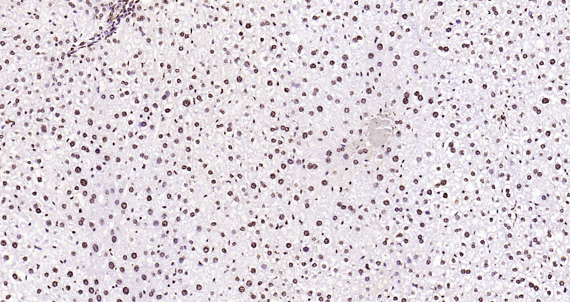 Paraformaldehyde-fixed, paraffin embedded Mouse liver; Antigen retrieval by boiling in sodium citrate buffer (pH6.0) for 15min; Block endogenous peroxidase by 3% hydrogen peroxide for 20 minutes; Blocking buffer (normal goat serum) at 37°C for 30min; Antibody incubation with Histone H3(di methyl K36) Monoclonal Antibody, Unconjugated (bsm-33124M) at 1:2000 overnight at 4°C, DAB staining.