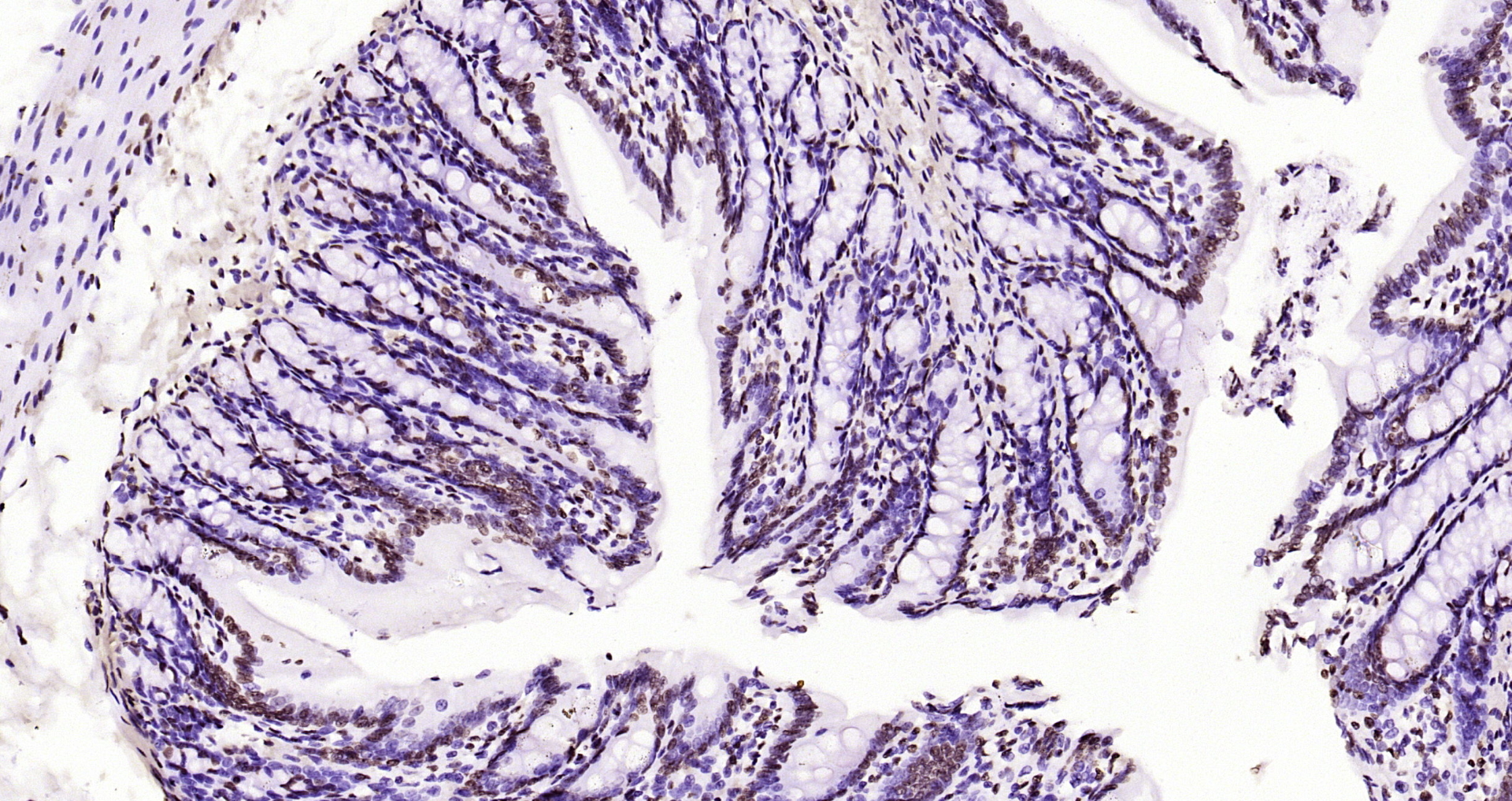 Paraformaldehyde-fixed, paraffin embedded Rat colon; Antigen retrieval by boiling in sodium citrate buffer (pH6.0) for 15min; Block endogenous peroxidase by 3% hydrogen peroxide for 20 minutes; Blocking buffer (normal goat serum) at 37°C for 30min; Antibody incubation with Histone H3(di methyl K36) Monoclonal Antibody, Unconjugated (bsm-33124M) at 1:2000 overnight at 4°C, DAB staining.