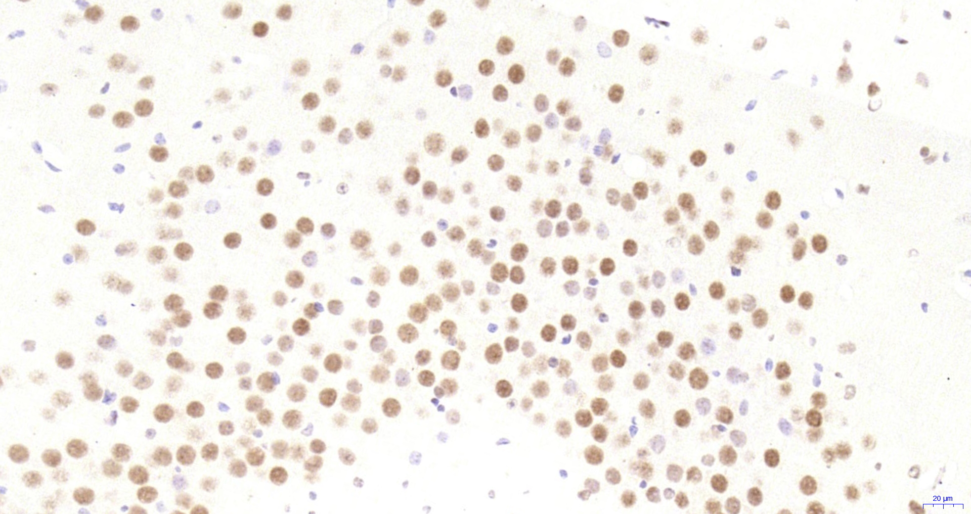 Paraformaldehyde-fixed, paraffin embedded Mouse brain; Antigen retrieval by boiling in sodium citrate buffer (pH6.0) for 15min; Block endogenous peroxidase by 3% hydrogen peroxide for 20 minutes; Blocking buffer (normal goat serum) at 37°C for 30min; Antibody incubation with HP1 gamma Monoclonal Antibody, Unconjugated (bsm-33375M) at 1:200 overnight at 4°C, DAB staining.