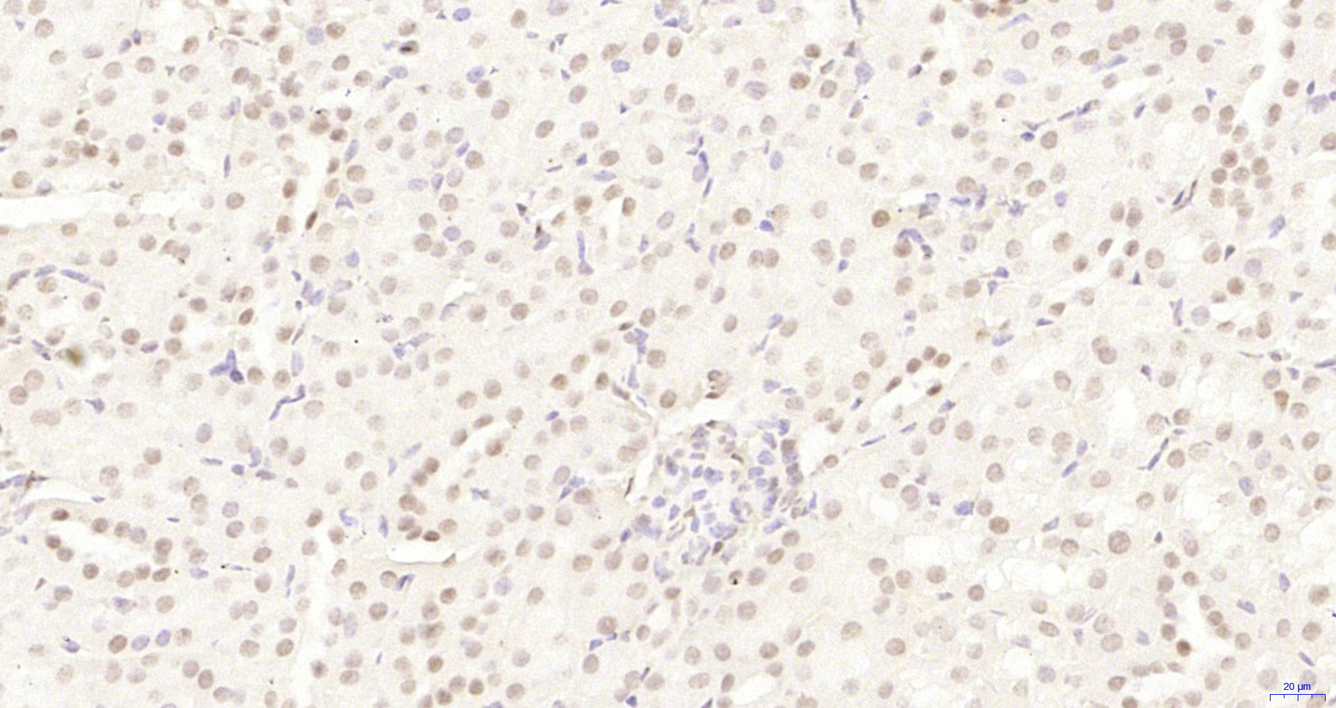 Paraformaldehyde-fixed, paraffin embedded Mouse kidney; Antigen retrieval by boiling in sodium citrate buffer (pH6.0) for 15min; Block endogenous peroxidase by 3% hydrogen peroxide for 20 minutes; Blocking buffer (normal goat serum) at 37°C for 30min; Antibody incubation with HP1 gamma Monoclonal Antibody, Unconjugated (bsm-33375M) at 1:200 overnight at 4°C, DAB staining.