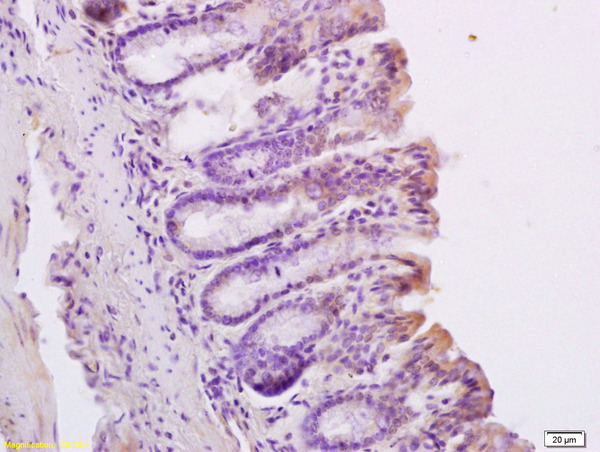 Formalin-fixed and paraffin embedded mouse intestine labeled with Anti TEP1 Polyclonal Antibody, Unconjugated (bs-1908R) at 1:200 followed by conjugation to the secondary antibody and DAB staining