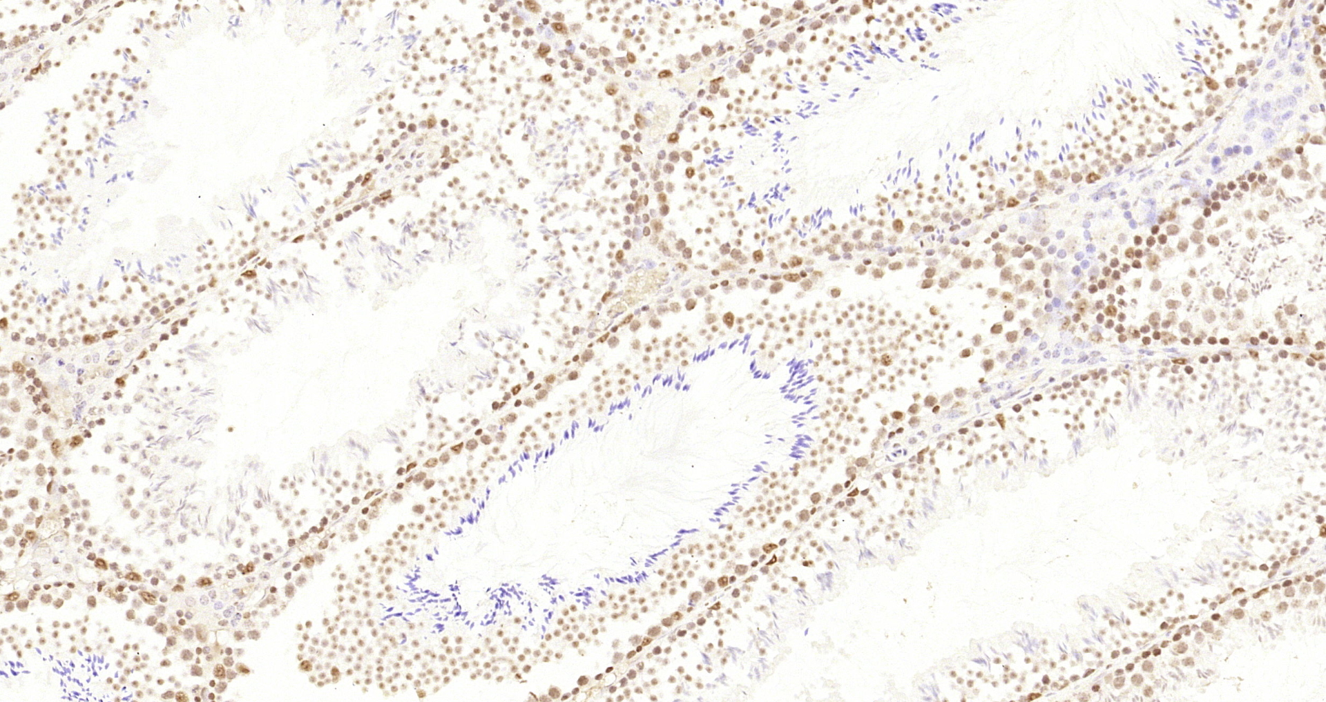 Paraformaldehyde-fixed, paraffin embedded Mouse testis; Antigen retrieval by boiling in sodium citrate buffer (pH6.0) for 15min; Block endogenous peroxidase by 3% hydrogen peroxide for 20 minutes; Blocking buffer (normal goat serum) at 37°C for 30min; Antibody incubation with HP1 gamma Monoclonal Antibody, Unconjugated (bsm-33375M) at 1:200 overnight at 4°C, DAB staining.