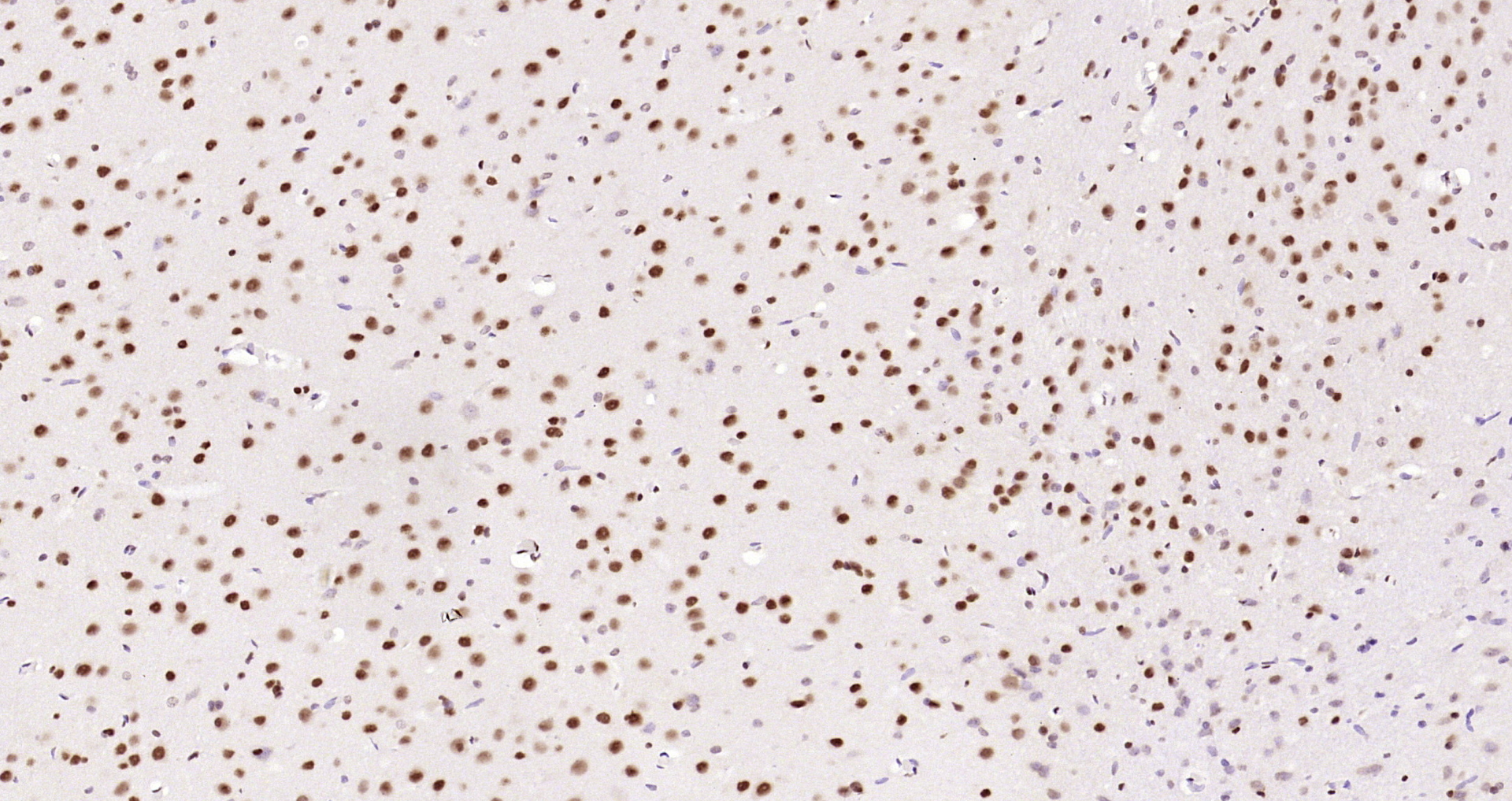 Paraformaldehyde-fixed, paraffin embedded Rat brain; Antigen retrieval by boiling in sodium citrate buffer (pH6.0) for 15min; Block endogenous peroxidase by 3% hydrogen peroxide for 20 minutes; Blocking buffer (normal goat serum) at 37°C for 30min; Antibody incubation with HP1 gamma Monoclonal Antibody, Unconjugated (bsm-33375M) at 1:200 overnight at 4°C, DAB staining.