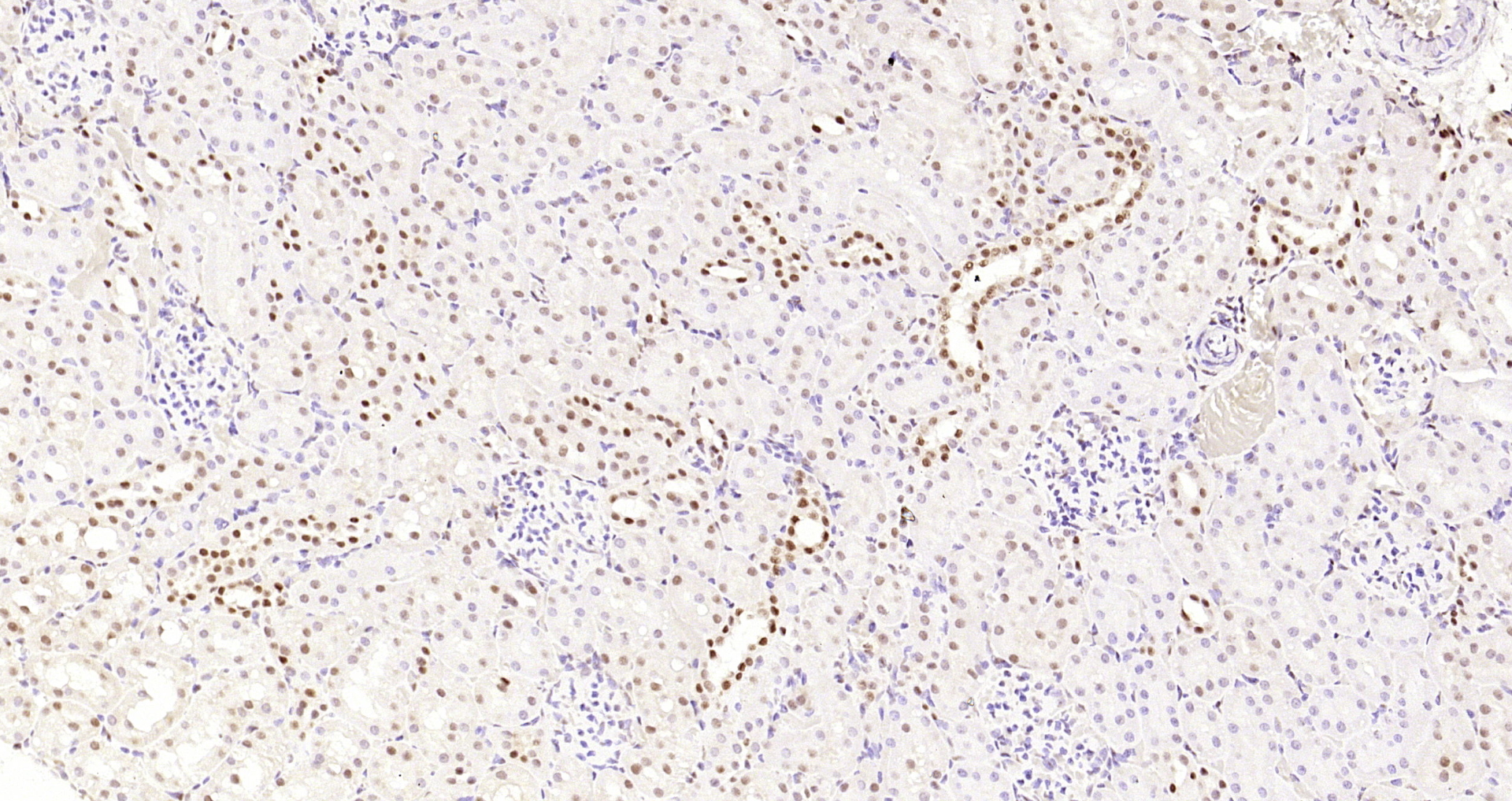 Paraformaldehyde-fixed, paraffin embedded Rat kidney; Antigen retrieval by boiling in sodium citrate buffer (pH6.0) for 15min; Block endogenous peroxidase by 3% hydrogen peroxide for 20 minutes; Blocking buffer (normal goat serum) at 37°C for 30min; Antibody incubation with HP1 gamma Monoclonal Antibody, Unconjugated (bsm-33375M) at 1:200 overnight at 4°C, DAB staining.