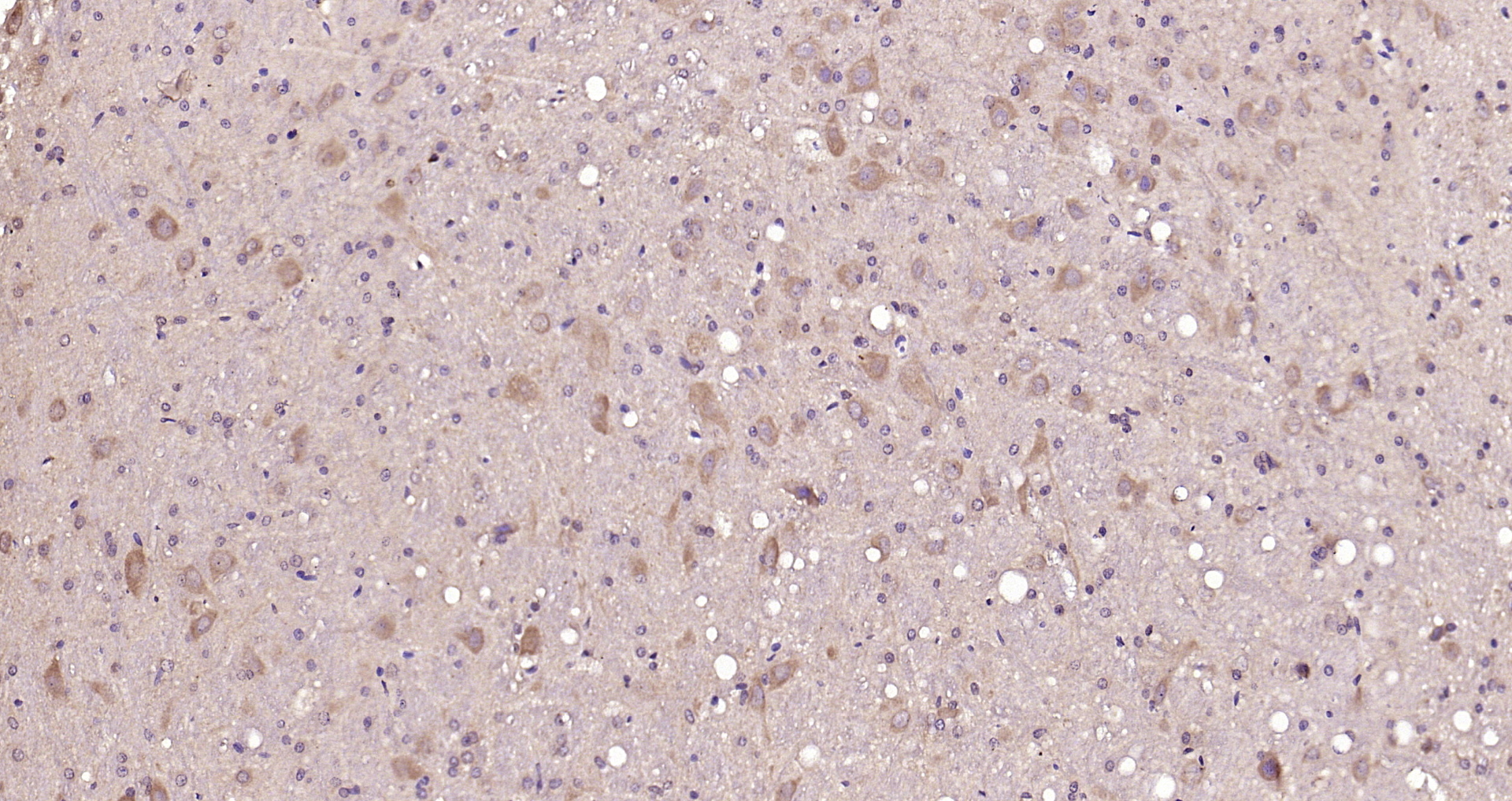Paraformaldehyde-fixed, paraffin embedded Rat brain; Antigen retrieval by boiling in sodium citrate buffer (pH6.0) for 15min; Block endogenous peroxidase by 3% hydrogen peroxide for 20 minutes; Blocking buffer (normal goat serum) at 37°C for 30min; Antibody incubation with Glucocorticoid receptor Polyclonal Antibody, Unconjugated (bs-0252R) at 1:200 overnight at 4°C, DAB staining. Paraformaldehyde-fixed, paraffin embedded Rat brain; Antigen retrieval by boiling in sodium citrate buffer (pH6.0) for 15min; Block endogenous peroxidase by 3% hydrogen peroxide for 20 minutes; Blocking buffer (normal goat serum) at 37°C for 30min; Antibody incubation with Glucocorticoid receptor Polyclonal Antibody, Unconjugated (bs-0252R) at 1:200 overnight at 4°C, DAB staining.