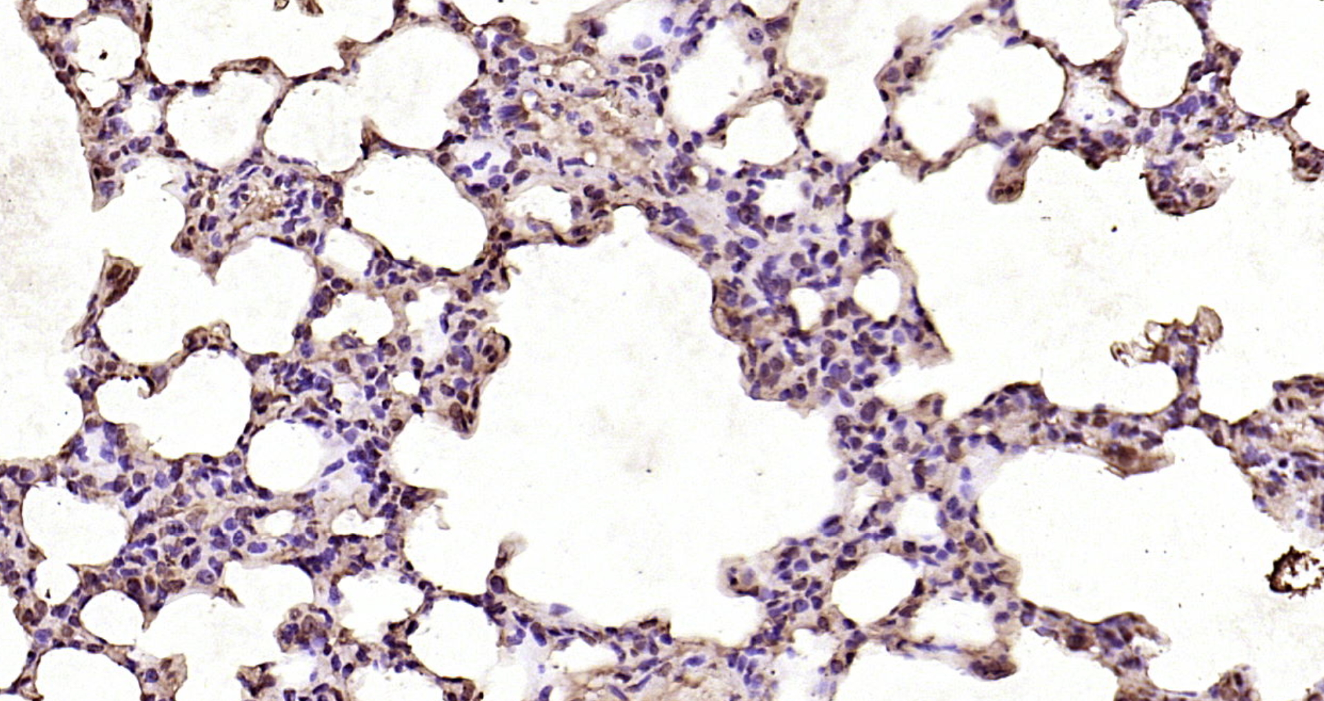 Paraformaldehyde-fixed, paraffin embedded Rat lung; Antigen retrieval by boiling in sodium citrate buffer (pH6.0) for 15min; Block endogenous peroxidase by 3% hydrogen peroxide for 20 minutes; Blocking buffer (normal goat serum) at 37°C for 30min; Antibody incubation with CDK6 Polyclonal Antibody, Unconjugated (bs-0568R) at 1:200 overnight at 4°C, DAB staining.