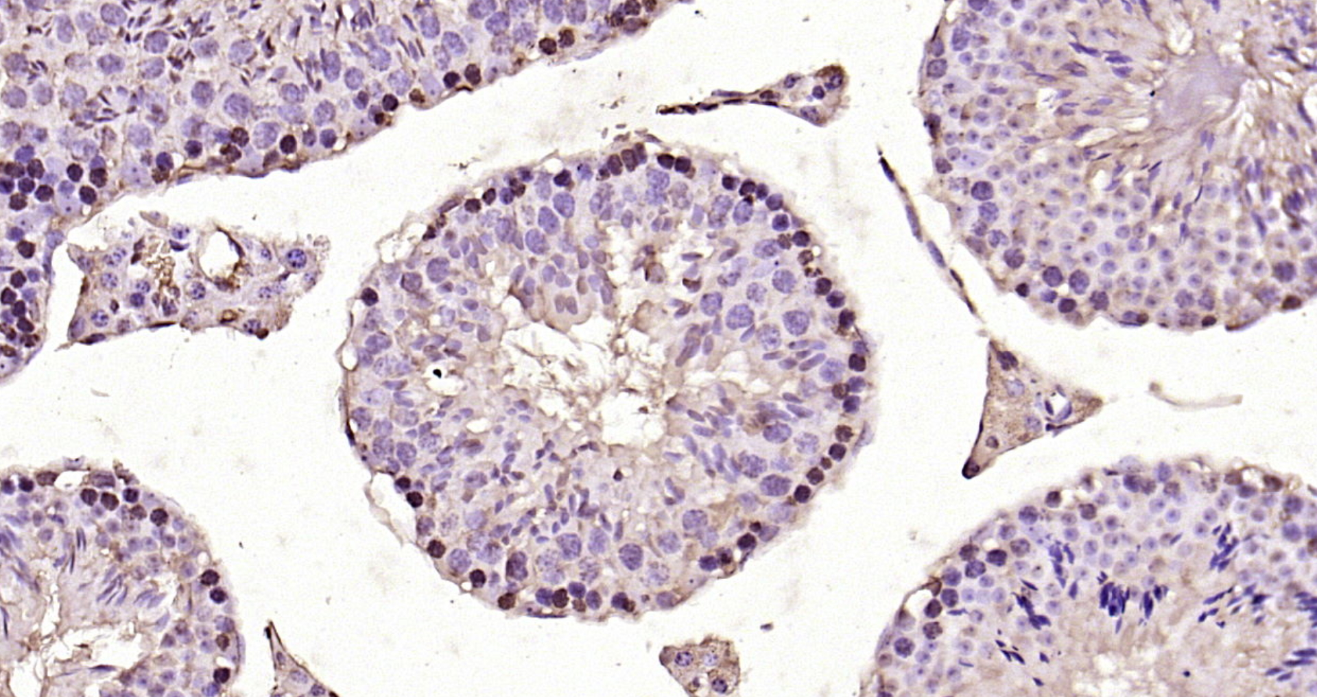 Paraformaldehyde-fixed, paraffin embedded Mouse testis; Antigen retrieval by boiling in sodium citrate buffer (pH6.0) for 15min; Block endogenous peroxidase by 3% hydrogen peroxide for 20 minutes; Blocking buffer (normal goat serum) at 37°C for 30min; Antibody incubation with CDK6 Polyclonal Antibody, Unconjugated (bs-0568R) at 1:200 overnight at 4°C, DAB staining.