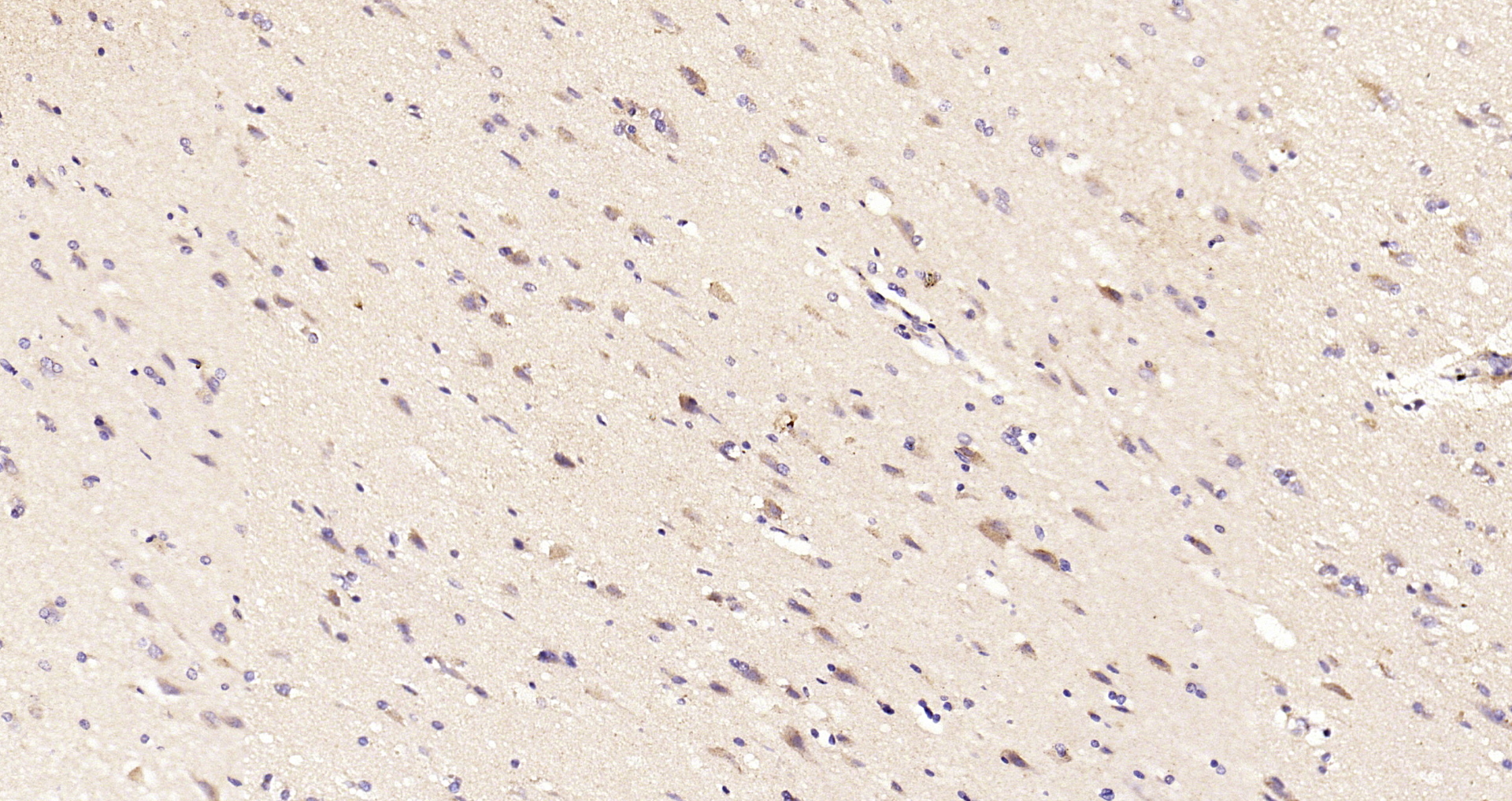 Paraformaldehyde-fixed, paraffin embedded Human brain; Antigen retrieval by boiling in sodium citrate buffer (pH6.0) for 15min; Block endogenous peroxidase by 3% hydrogen peroxide for 20 minutes; Blocking buffer (normal goat serum) at 37°C for 30min; Antibody incubation with TSSC3 Polyclonal Antibody, Unconjugated (bs-6884R) at 1:200 overnight at 4°C, DAB staining. Paraformaldehyde-fixed, paraffin embedded Human brain; Antigen retrieval by boiling in sodium citrate buffer (pH6.0) for 15min; Block endogenous peroxidase by 3% hydrogen peroxide for 20 minutes; Blocking buffer (normal goat serum) at 37°C for 30min; Antibody incubation with TSSC3 Polyclonal Antibody, Unconjugated (bs-6884R) at 1:200 overnight at 4°C, DAB staining.