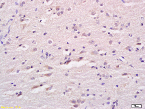 Formalin-fixed and paraffin embedded rat brain labeled with Anti LCAT Polyclonal Antibody, Unconjugated (bs-1972R) at 1:200 followed by conjugation to the secondary antibody and DAB staining