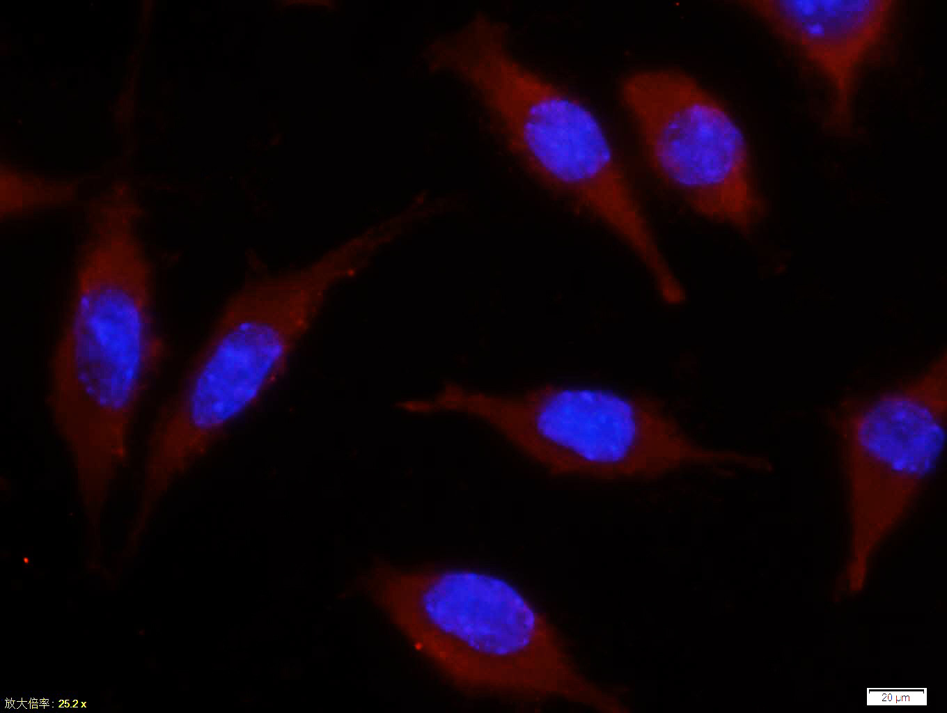 Tissue/cell: Sh-sy5y cell; 4% Paraformaldehyde-fixed; Triton X-100 at room temperature for 20 min; Blocking buffer (normal goat serum, C-0005) at 37°C for 20 min; Antibody incubation with (Bax) polyclonal Antibody, Unconjugated (bs-0127M) 1:100, 90 minutes at 37°C; followed by a CY3 conjugated Goat Anti-Mouse IgG antibody at 37°C for 90 minutes, DAPI (blue, C02-04002) was used to stain the cell nuclei.