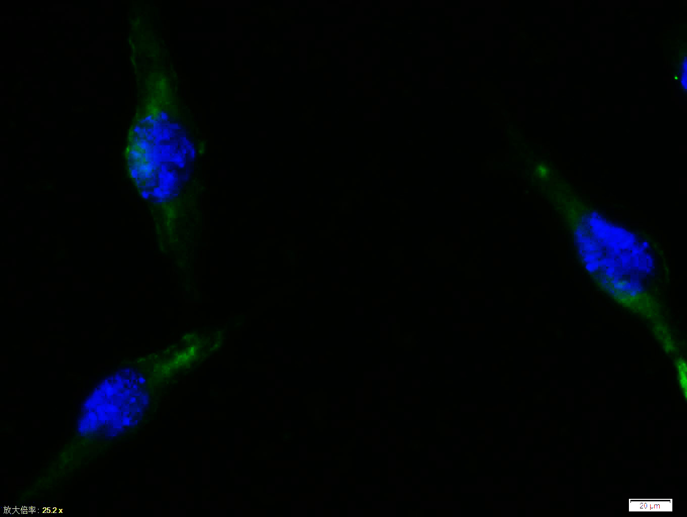 Tissue/cell:Sh-sy5y cell; 4% Paraformaldehyde-fixed; Triton X-100 at room temperature for 20 min; Blocking buffer (normal goat serum, C-0005) at 37°C for 20 min; Antibody incubation with (Cytochrome C) polyclonal Antibody, Unconjugated (bs-0013R) 1:100, 90 minutes at 37°C; followed by a FITC conjugated Goat Anti-Rabbit IgG antibody at 37°C for 90 minutes, DAPI (blue, C02-04002) was used to stain the cell nuclei.