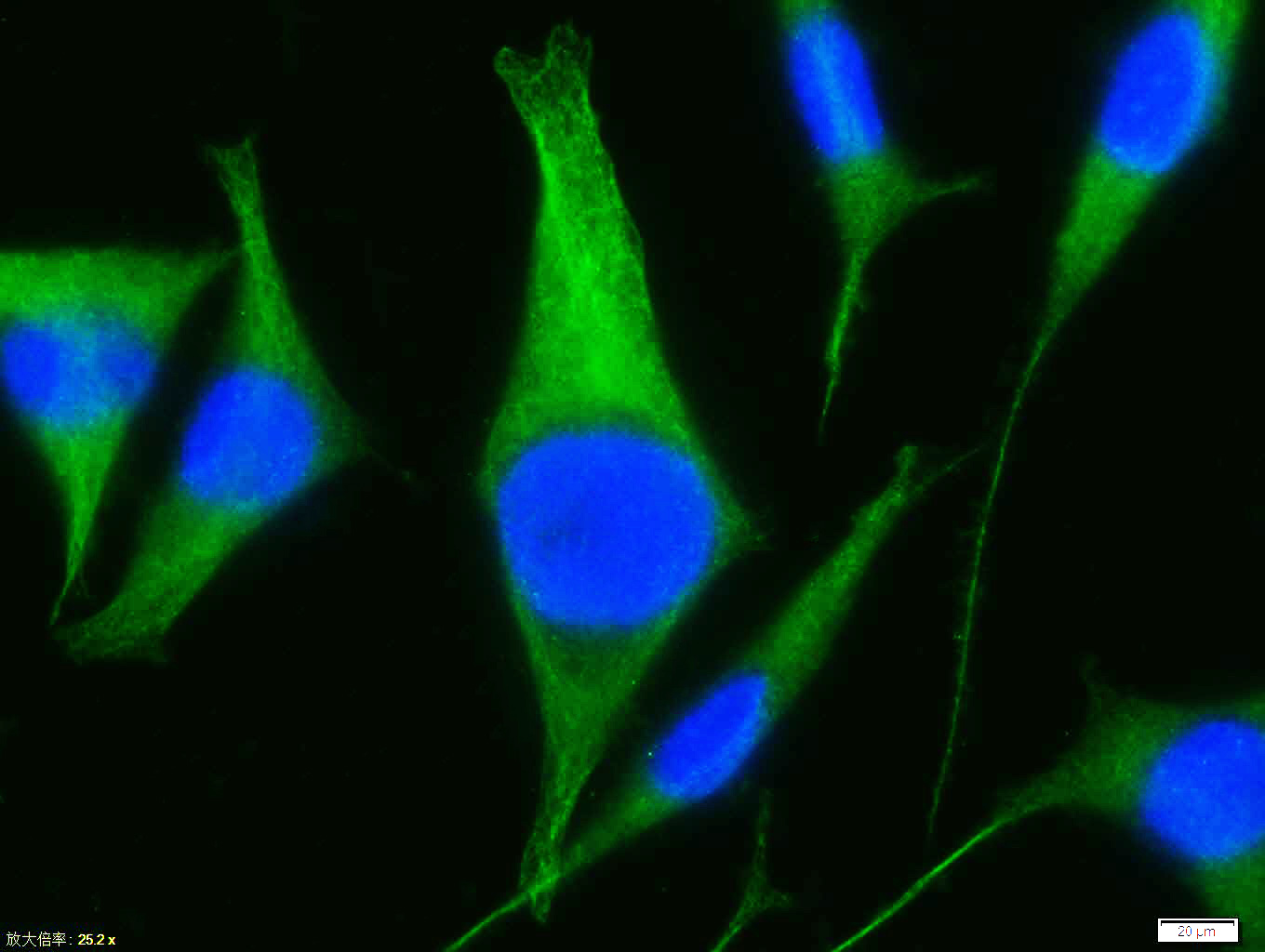 Tissue/cell:Sh-sy5y cell; 4% Paraformaldehyde-fixed; Triton X-100 at room temperature for 20 min; Blocking buffer (normal goat serum, C-0005) at 37°C for 20 min; Antibody incubation with (Beta tubulin) polyclonal Antibody, Unconjugated (bs-4511R) 1:100, 90 minutes at 37°C; followed by a FITC conjugated Goat Anti-Rabbit IgG antibody at 37°C for 90 minutes, DAPI (blue, C02-04002) was used to stain the cell nuclei.