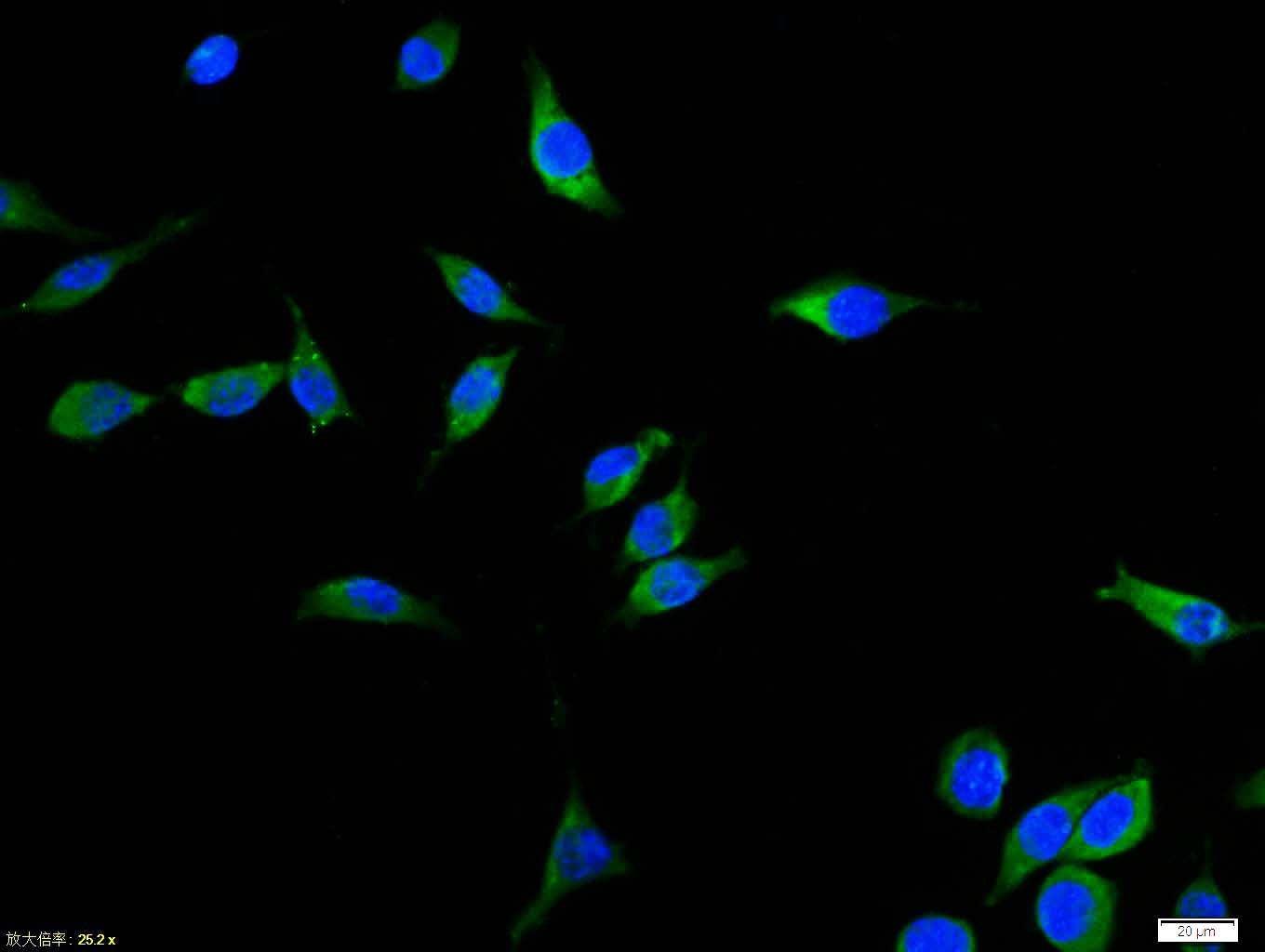 Tissue/cell:Sh-sy5y cell; 4% Paraformaldehyde-fixed; Triton X-100 at room temperature for 20 min; Blocking buffer (normal goat serum, C-0005) at 37°C for 20 min; Antibody incubation with (Bax) polyclonal Antibody, Unconjugated (bs-0127R) 1:100, 90 minutes at 37°C; followed by a FITC conjugated Goat Anti-Rabbit IgG antibody at 37°C for 90 minutes, DAPI (blue, C02-04002) was used to stain the cell nuclei.