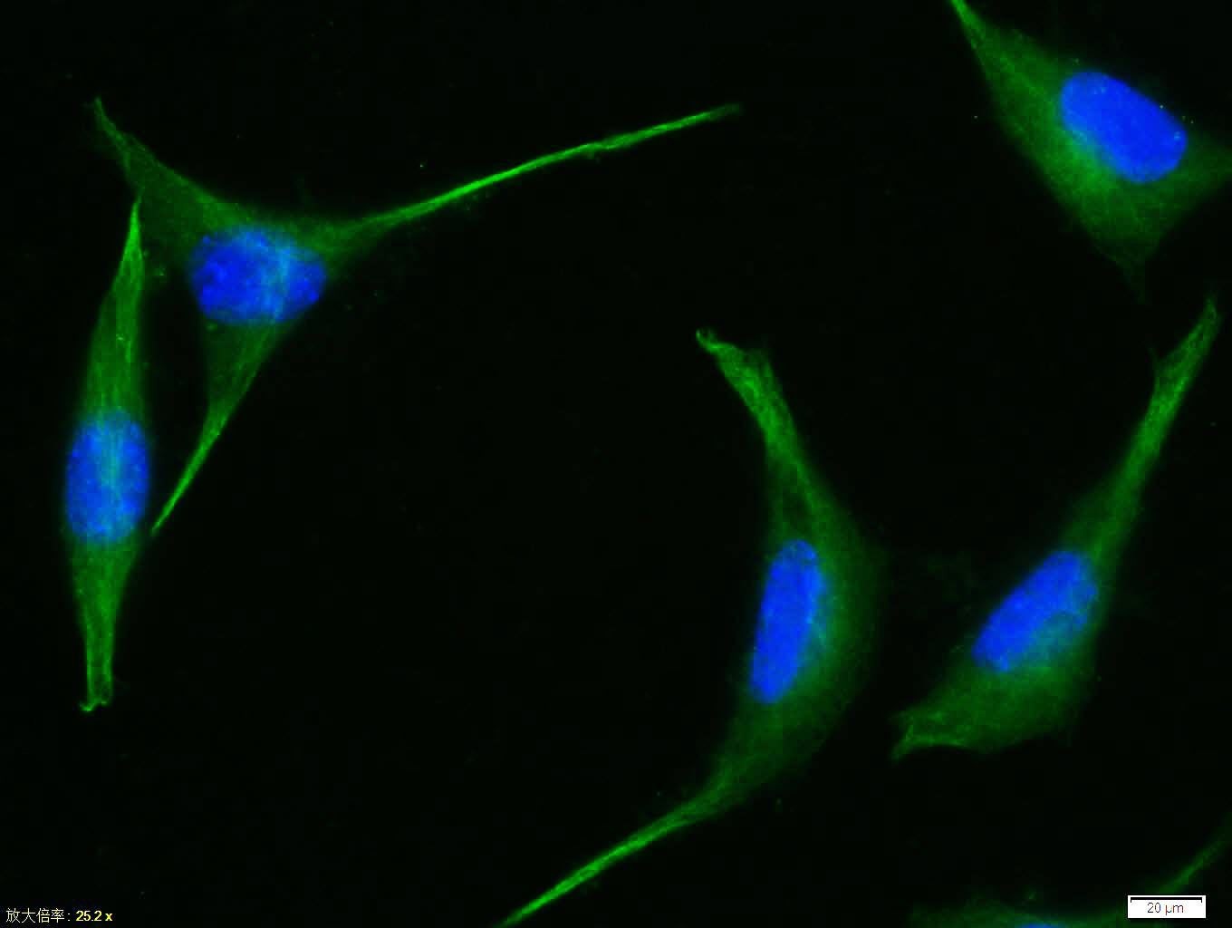 Tissue/cell:Sh-sy5y cell; 4% Paraformaldehyde-fixed; Triton X-100 at room temperature for 20 min; Blocking buffer (normal goat serum, C-0005) at 37°C for 20 min; Antibody incubation with (Tubulin-beta) polyclonal Antibody, Unconjugated (bs-0210R) 1:100, 90 minutes at 37°C; followed by a FITC conjugated Goat Anti-Rabbit IgG antibody at 37°C for 90 minutes, DAPI (blue, C02-04002) was used to stain the cell nuclei.
