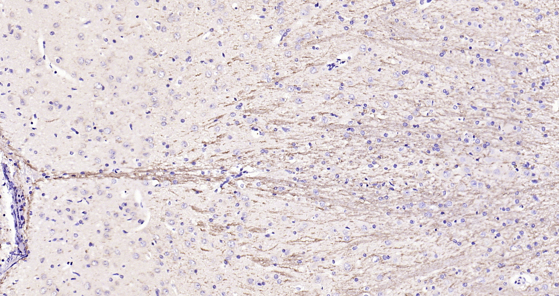 Paraformaldehyde-fixed, paraffin embedded Rat brain; Antigen retrieval by boiling in sodium citrate buffer (pH6.0) for 15min; Block endogenous peroxidase by 3% hydrogen peroxide for 20 minutes; Blocking buffer (normal goat serum) at 37°C for 30min; Antibody incubation with Notch1/MOTC Polyclonal Antibody, Unconjugated (bs-1335R) at 1:200 overnight at 4°C, DAB staining.