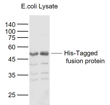 His-Tagged Fusion Protein Overexpression E.coli Lysates (Cat#: bs-41403P) probed with His Tag Polyclonall Antibody, Unconjugated (bs-10582R) at 1:1000 dilution and 4˚C overnight incubation. Followed by conjugated secondary antibody incubation at 1:20000 for 60 min at 37˚C.
