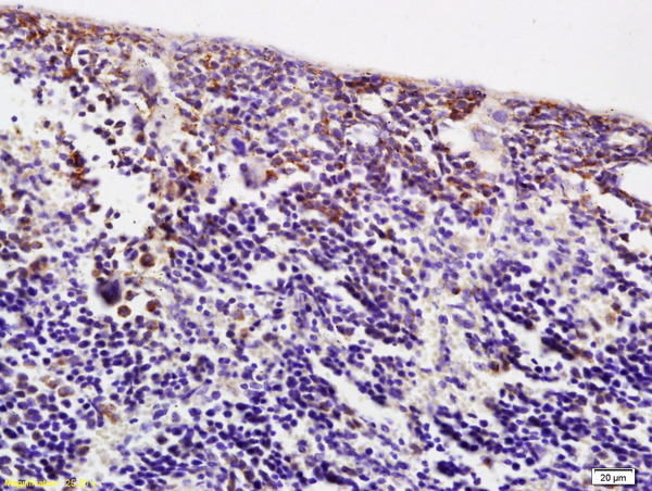 Formalin-fixed and paraffin embedded mouse spleen labeled with Anti ACBD6 Polyclonal Antibody, Unconjugated (bs-6017R) at 1:200 followed by conjugation to the secondary antibody and DAB staining