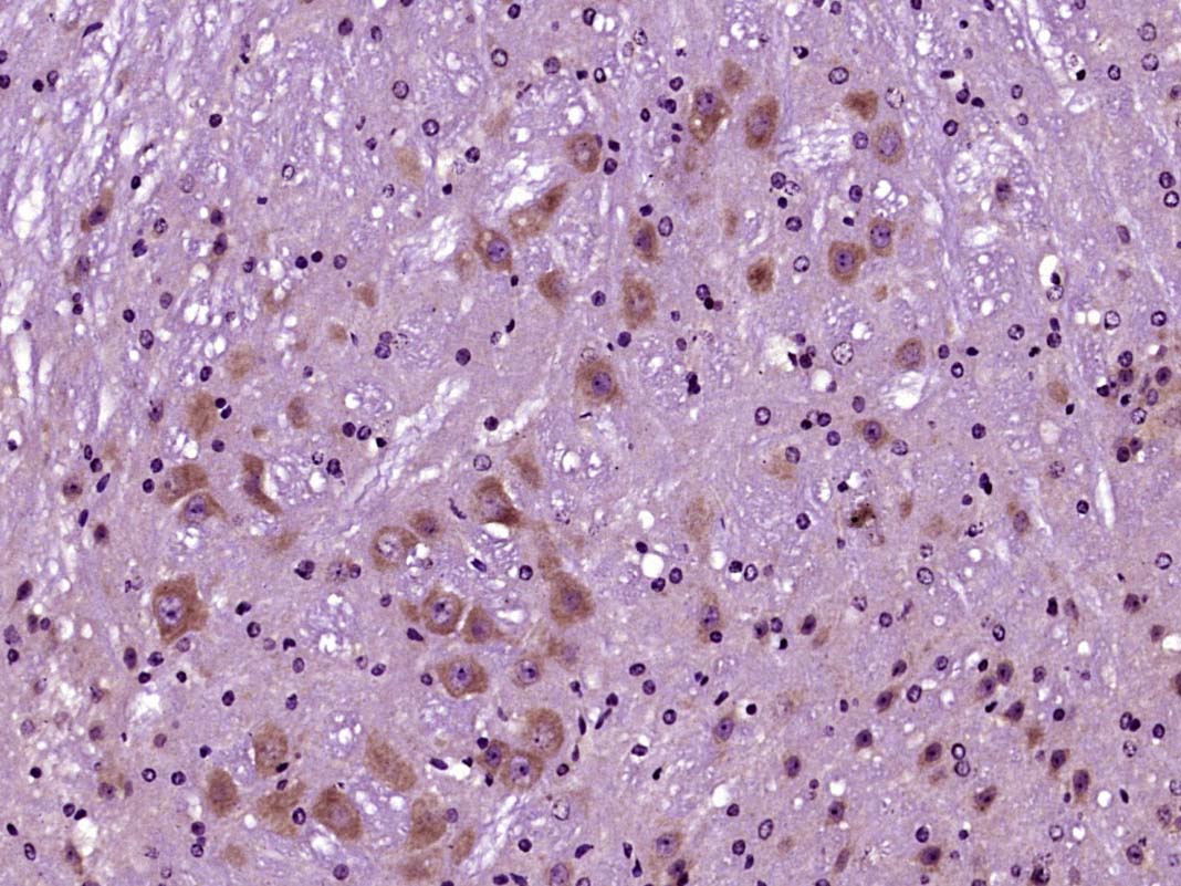 Paraformaldehyde-fixed, paraffin embedded Mouse brain; Antigen retrieval by boiling in sodium citrate buffer (pH6.0) for 15min; Block endogenous peroxidase by 3% hydrogen peroxide for 20 minutes; Blocking buffer (normal goat serum) at 37°C for 30min; Antibody incubation with SIRT1 Polyclonal Antibody, Unconjugated (bs-0921R) at 1:400 overnight at 4°C, DAB staining.