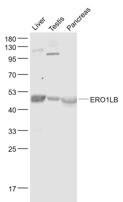 Lane 1: Rat Liver lysates; Lane 2: Rat Testis lysates; Lane 3: Pancreas lysates probed with ERO1LB Polyclonal Antibody, Unconjugated (bs-14627R) at 1:1000 dilution and 4˚C overnight incubation. Followed by conjugated secondary antibody incubation at 1:20000 for 60 min at 37˚C.