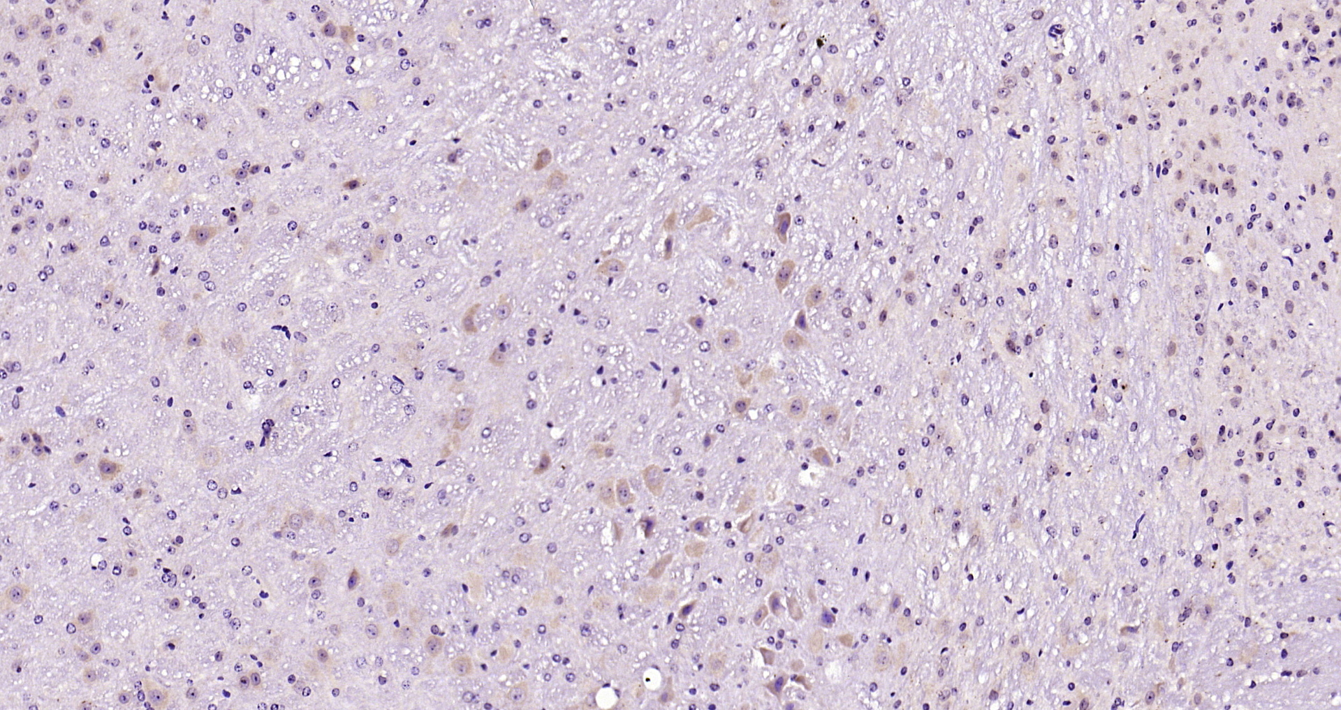 Paraformaldehyde-fixed, paraffin embedded Mouse brain; Antigen retrieval by boiling in sodium citrate buffer (pH6.0) for 15min; Block endogenous peroxidase by 3% hydrogen peroxide for 20 minutes; Blocking buffer (normal goat serum) at 37°C for 30min; Antibody incubation with JNK1+2+3 Polyclonal Antibody, Unconjugated (bs-2592R) at 1:200 overnight at 4°C, DAB staining.