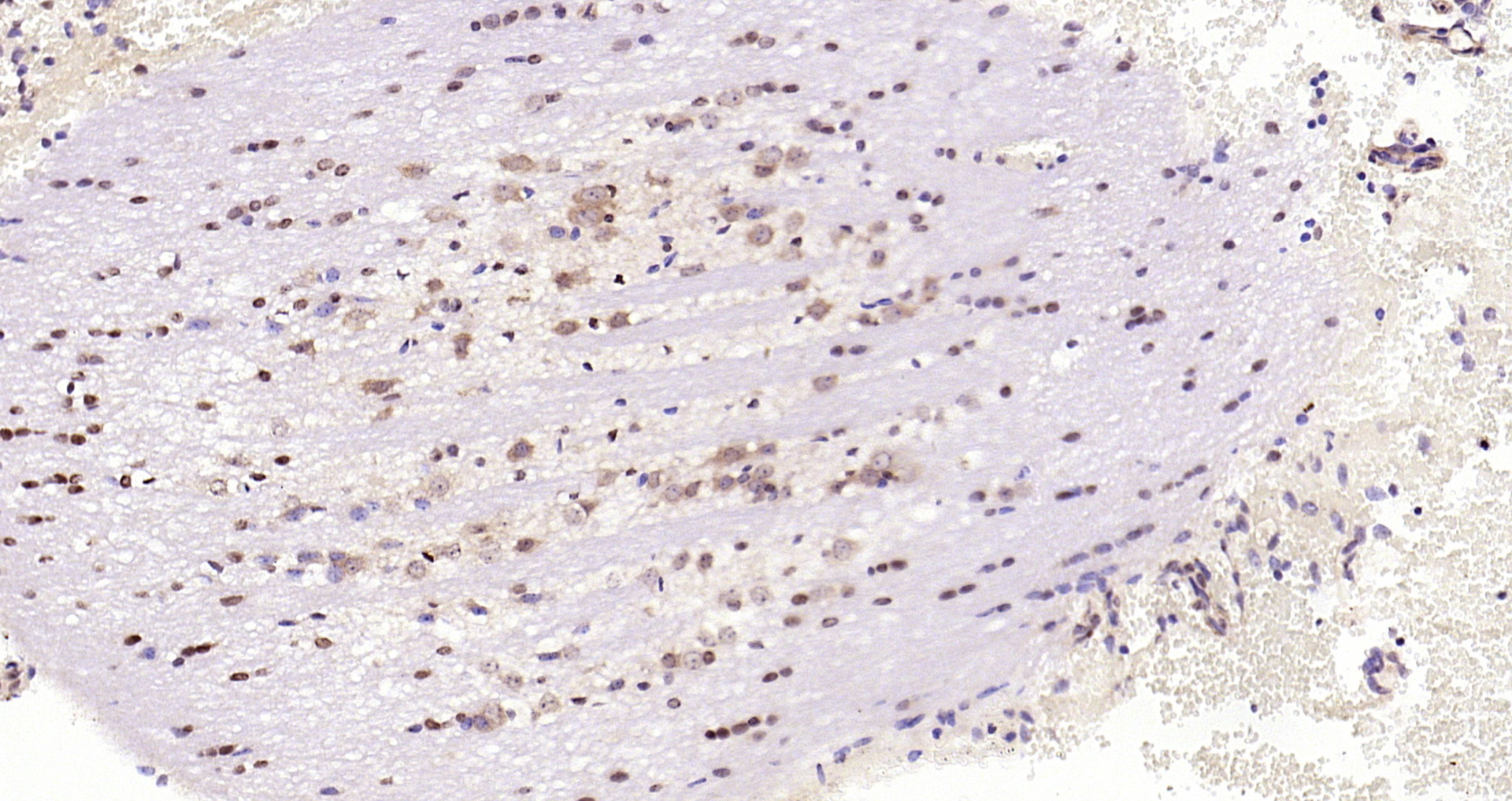 Paraformaldehyde-fixed, paraffin embedded Mouse brain; Antigen retrieval by boiling in sodium citrate buffer (pH6.0) for 15min; Block endogenous peroxidase by 3% hydrogen peroxide for 20 minutes; Blocking buffer (normal goat serum) at 37°C for 30min; Antibody incubation with JNK1 + JNK2 + JNK3 (T183 + T183 + T221) Polyclonal Antibody, Unconjugated (bs-4163R) at 1:200 overnight at 4°C, DAB staining.