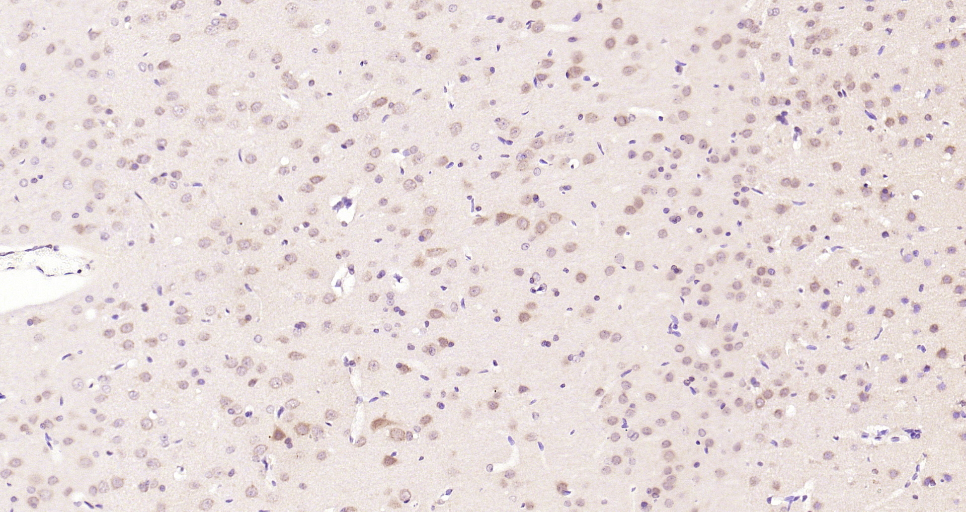 Paraformaldehyde-fixed, paraffin embedded Rat brain; Antigen retrieval by boiling in sodium citrate buffer (pH6.0) for 15min; Block endogenous peroxidase by 3% hydrogen peroxide for 20 minutes; Blocking buffer (normal goat serum) at 37°C for 30min; Antibody incubation with JNK1 + JNK2 + JNK3 (T183 + T183 + T221) Polyclonal Antibody, Unconjugated (bs-4163R) at 1:200 overnight at 4°C, DAB staining.