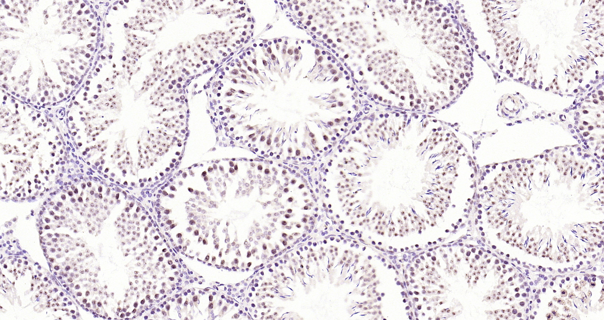 Paraformaldehyde-fixed, paraffin embedded Rat testis; Antigen retrieval by boiling in sodium citrate buffer (pH6.0) for 15min; Block endogenous peroxidase by 3% hydrogen peroxide for 20 minutes; Blocking buffer (normal goat serum) at 37°C for 30min; Antibody incubation with RSK1(S380) (7A12) Monoclonal Antibody, Unconjugated (bsm-52199R) at 1:200 overnight at 4°C, DAB staining.