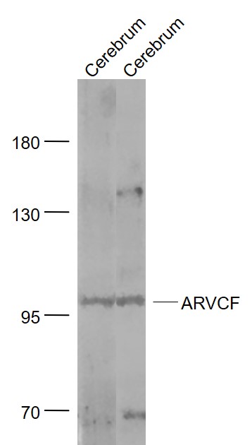 Lane 1: Mouse Cerebrum lysates; Lane 2: Rat Cerebrum lysates probed with ARVCF Polyclonal Antibody, Unconjugated (bs-12532R) at 1:1000 dilution and 4˚C overnight incubation. Followed by conjugated secondary antibody incubation at 1:20000 for 60 min at 37˚C.
