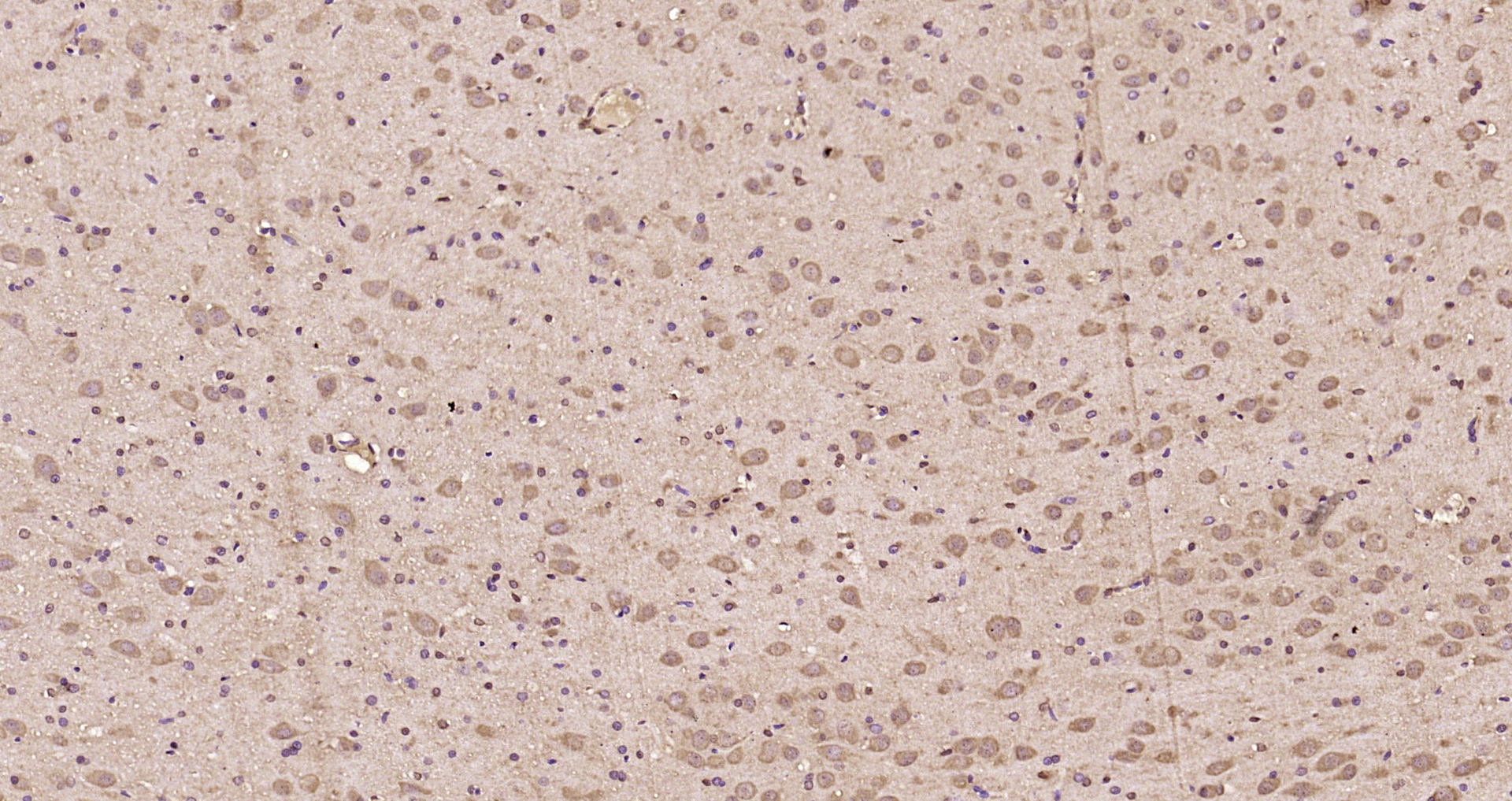 Paraformaldehyde-fixed, paraffin embedded Rat brain; Antigen retrieval by boiling in sodium citrate buffer (pH6.0) for 15min; Block endogenous peroxidase by 3% hydrogen peroxide for 20 minutes; Blocking buffer (normal goat serum) at 37°C for 30min; Antibody incubation with CNR-2/PCDHA6 Polyclonal Antibody, Unconjugated (bs-1711R) at 1:200 overnight at 4°C, DAB staining.